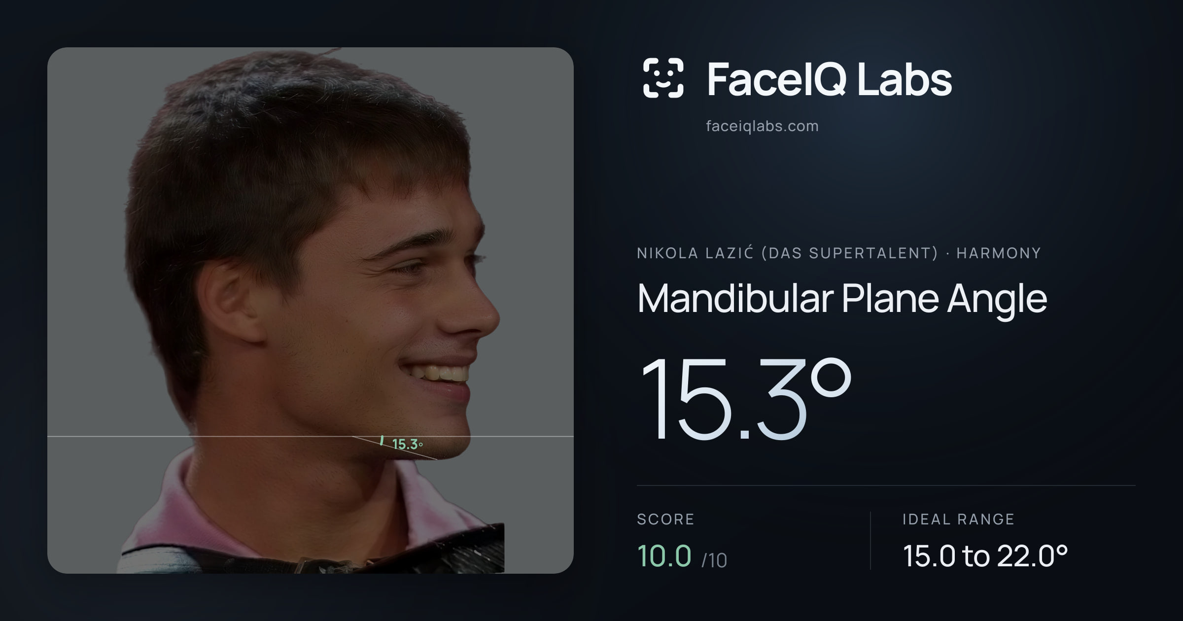 Nikola Lazić (Das Supertalent) Mandibular Plane Angle: 15.3°, drawn on the photo
