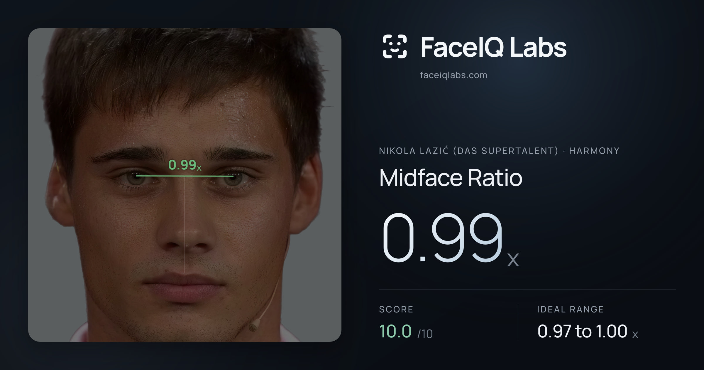 Nikola Lazić (Das Supertalent) Midface Ratio: 0.99x, drawn on the photo