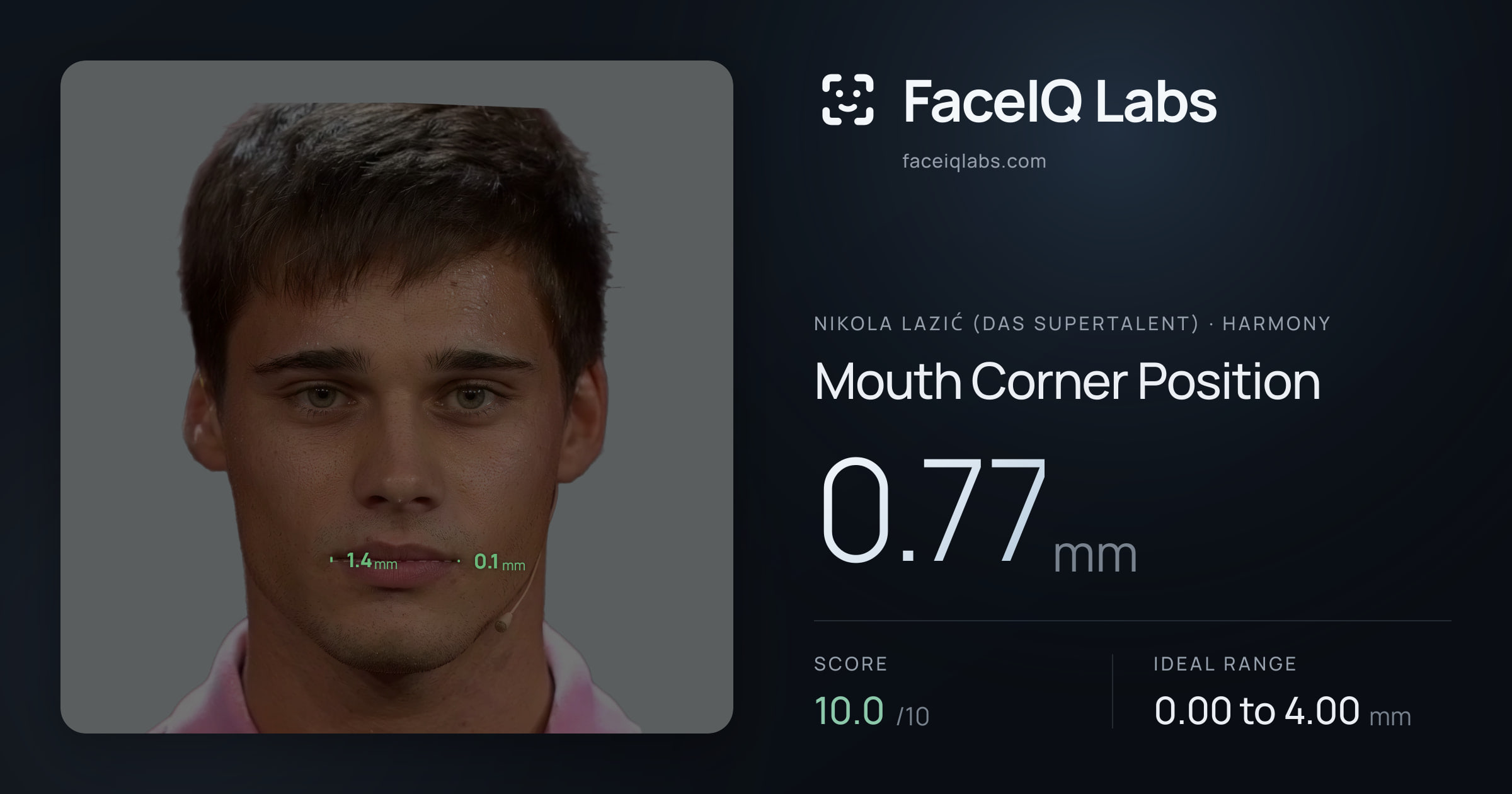 Nikola Lazić (Das Supertalent) Mouth Corner Position: 0.77mm, drawn on the photo