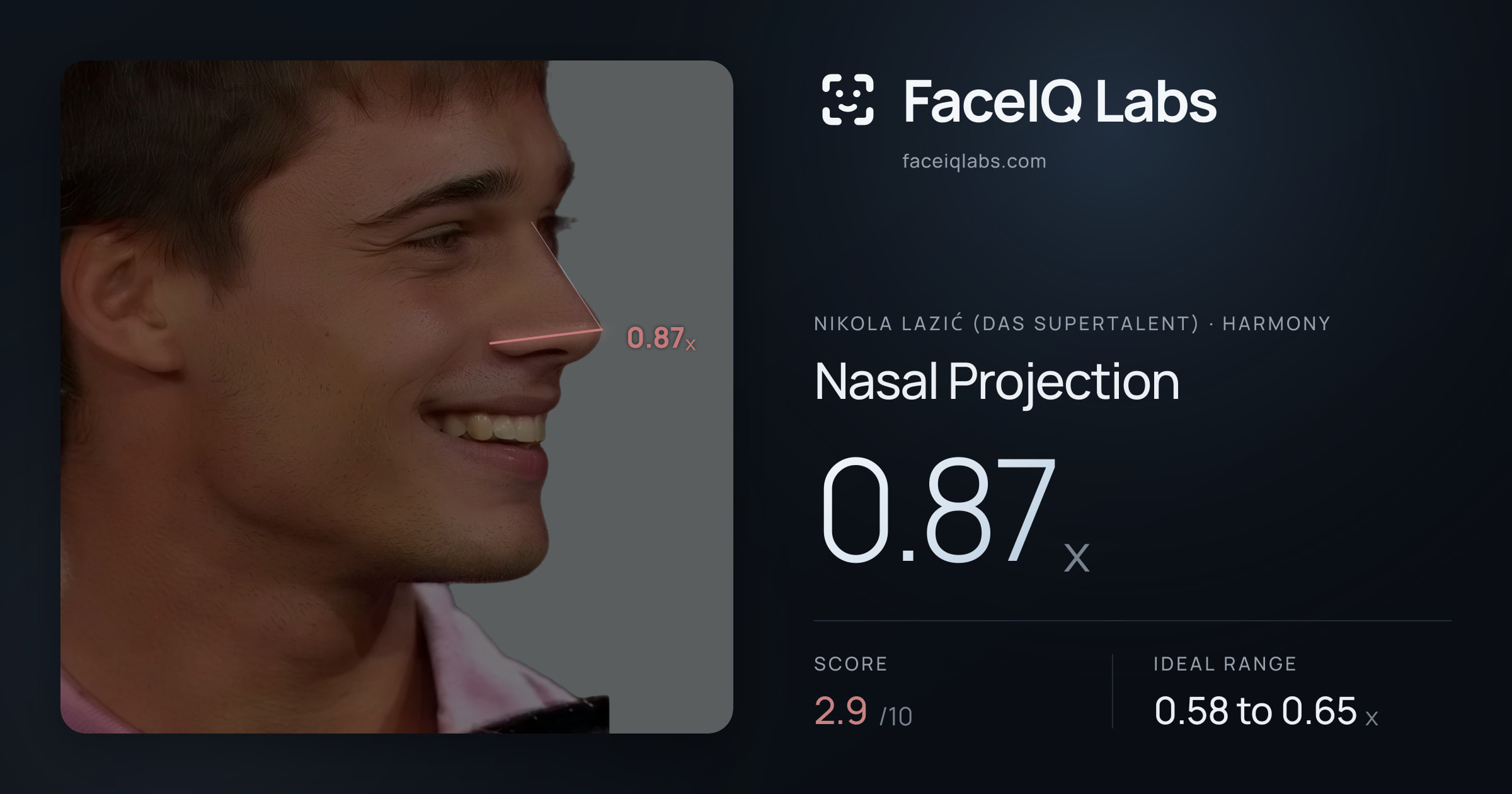 Nikola Lazić (Das Supertalent) Nasal Projection: 0.87x, drawn on the photo