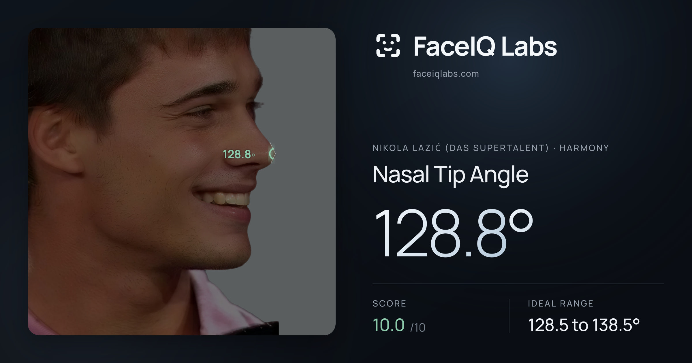 Nikola Lazić (Das Supertalent) Nasal Tip Angle: 128.8°, drawn on the photo