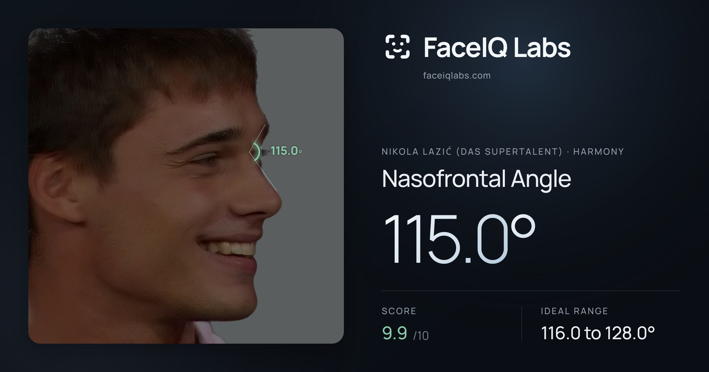 Nikola Lazić (Das Supertalent) Nasofrontal Angle: 115.0°, drawn on the photo