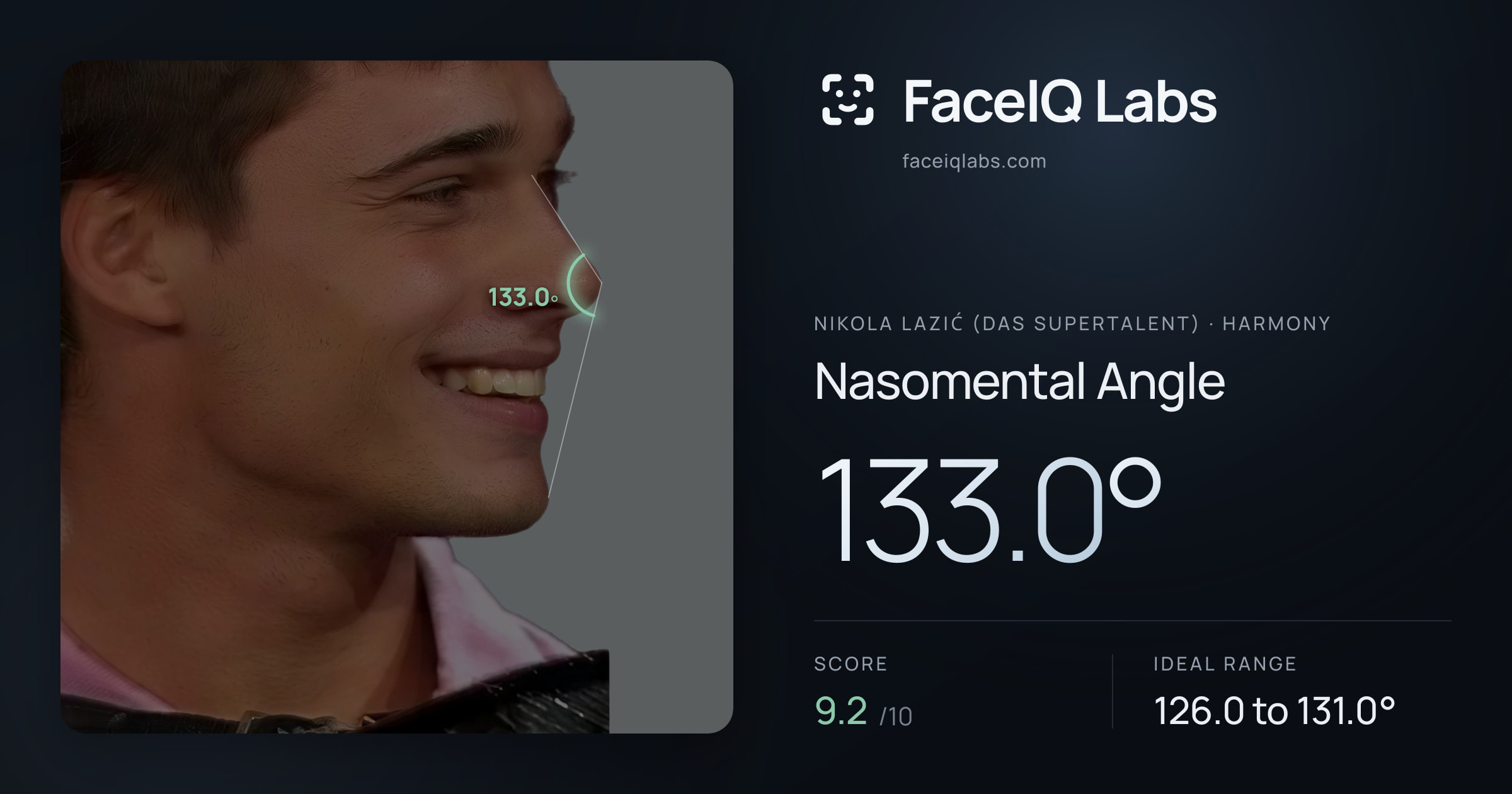 Nikola Lazić (Das Supertalent) Nasomental Angle: 133.0°, drawn on the photo