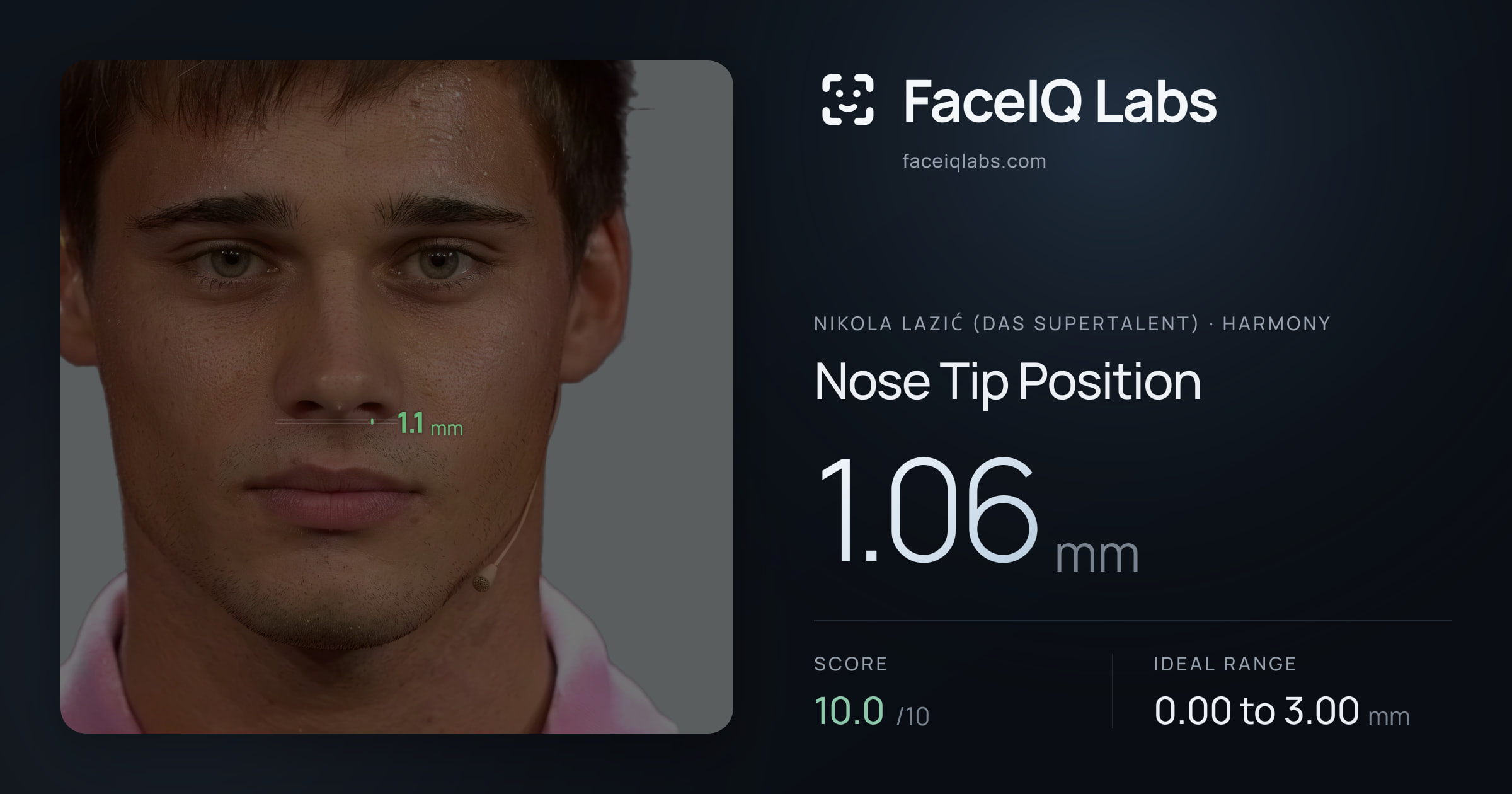 Nikola Lazić (Das Supertalent) Nose Tip Position: 1.06mm, drawn on the photo