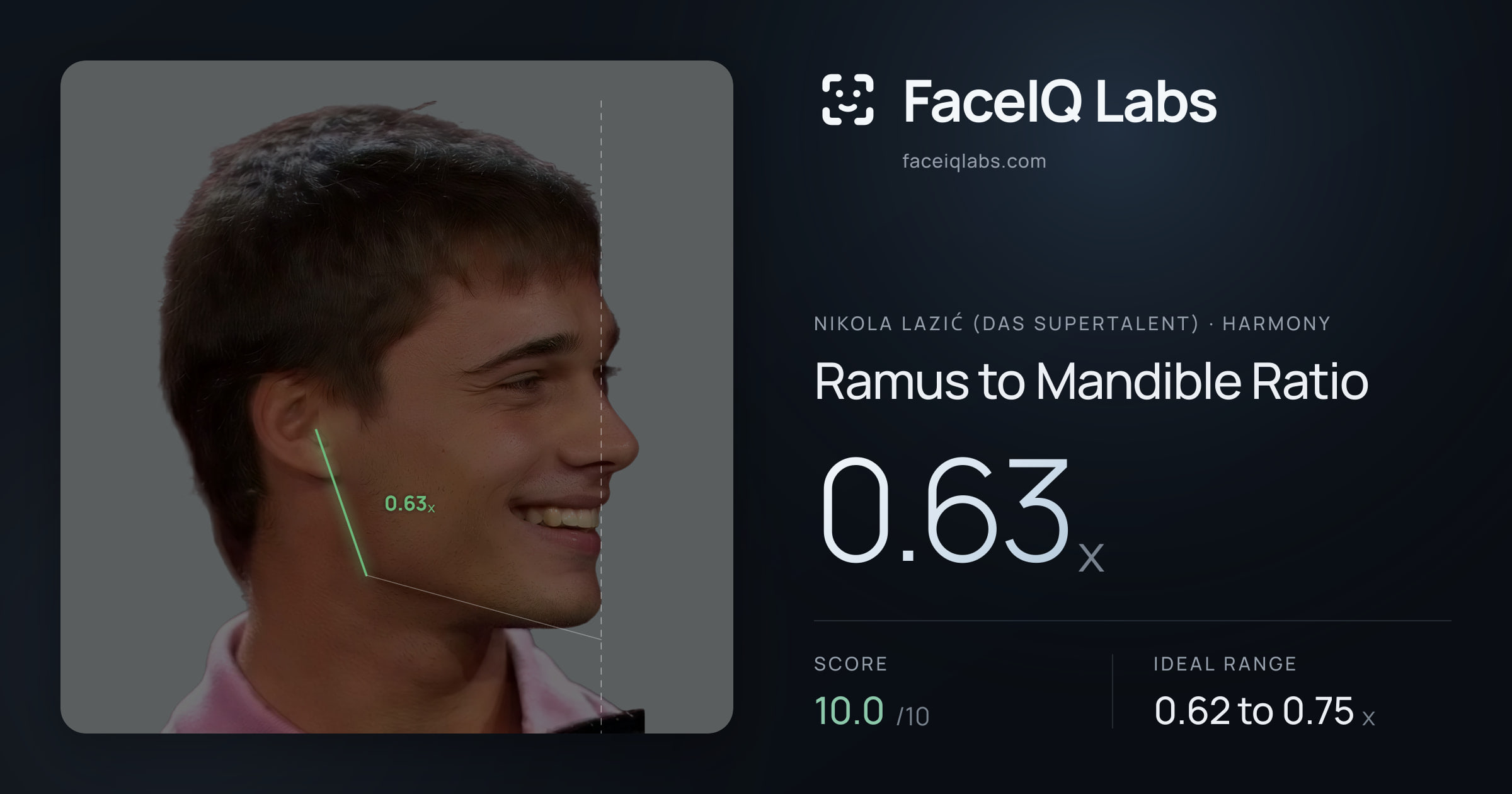 Nikola Lazić (Das Supertalent) Ramus to Mandible Ratio: 0.63x, drawn on the photo