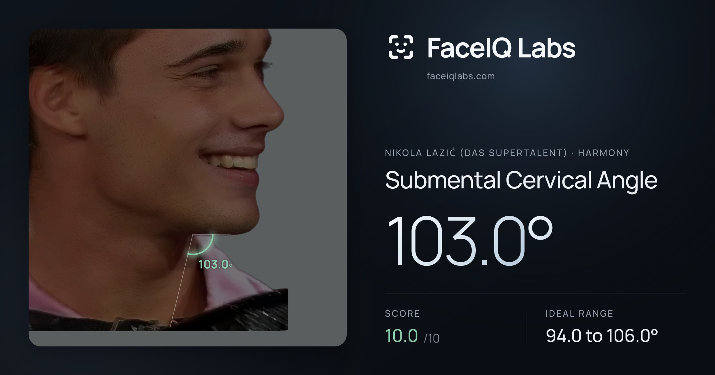 Nikola Lazić (Das Supertalent) Submental Cervical Angle: 103.0°, drawn on the photo
