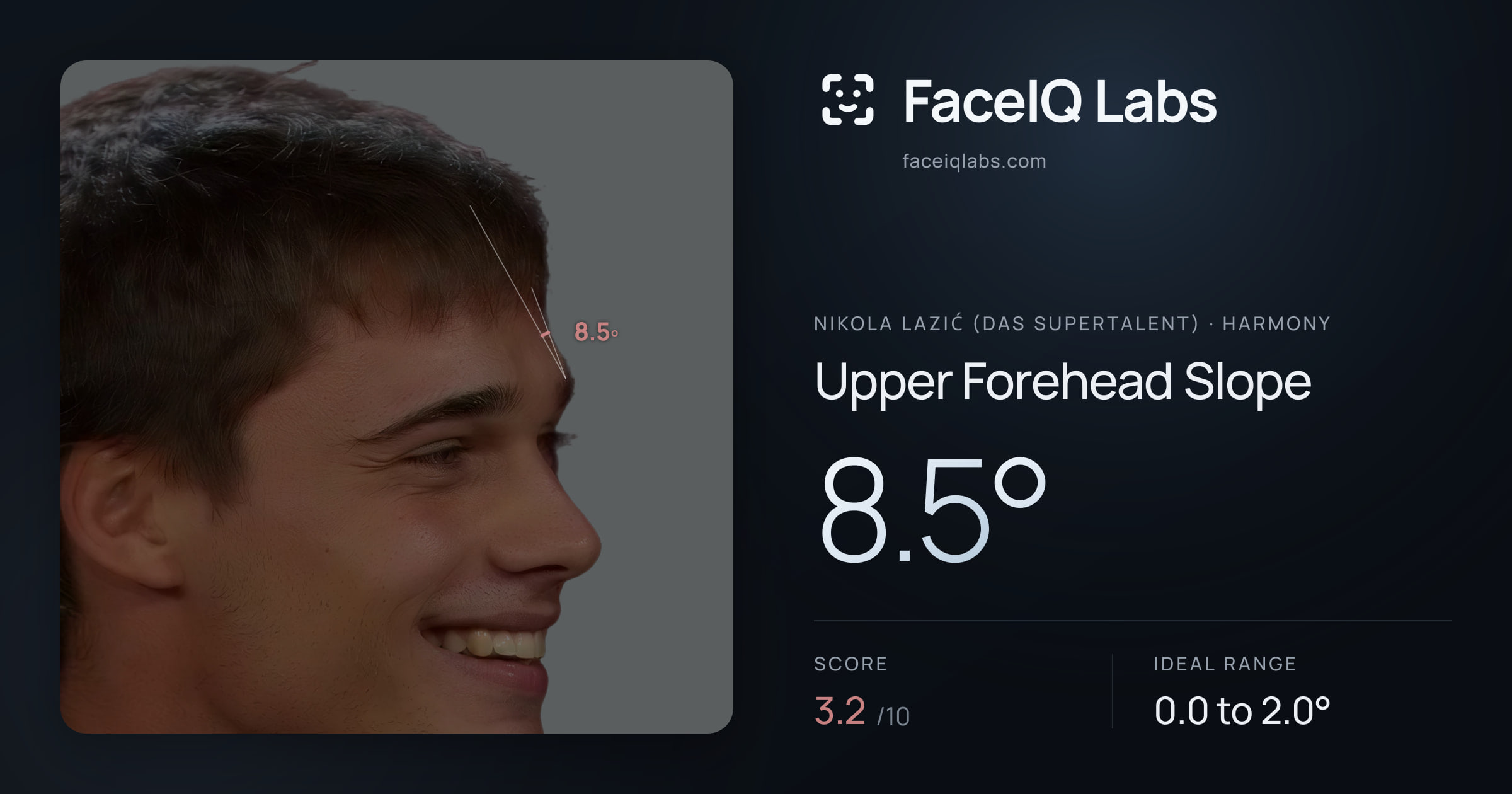 Nikola Lazić (Das Supertalent) Upper Forehead Slope: 8.5°, drawn on the photo