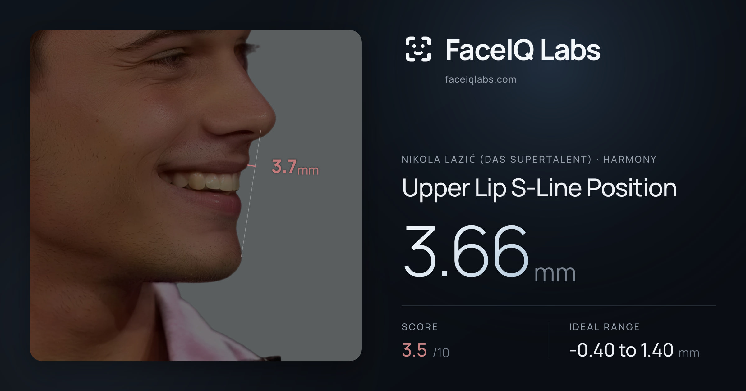 Nikola Lazić (Das Supertalent) Upper Lip S-Line Position: 3.66mm, drawn on the photo