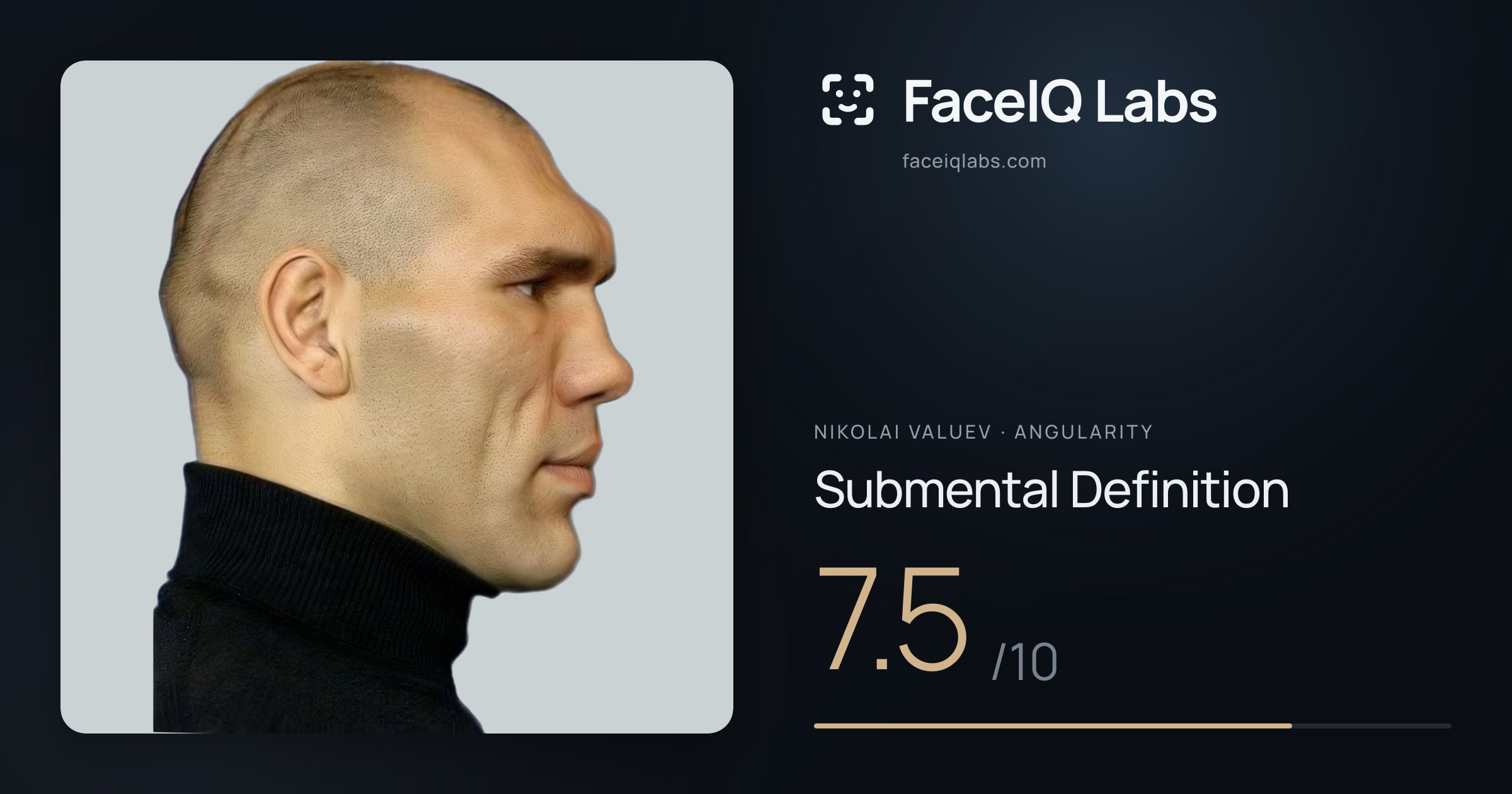Nikolai Valuev Submental Definition: 7.5/10, drawn on the photo