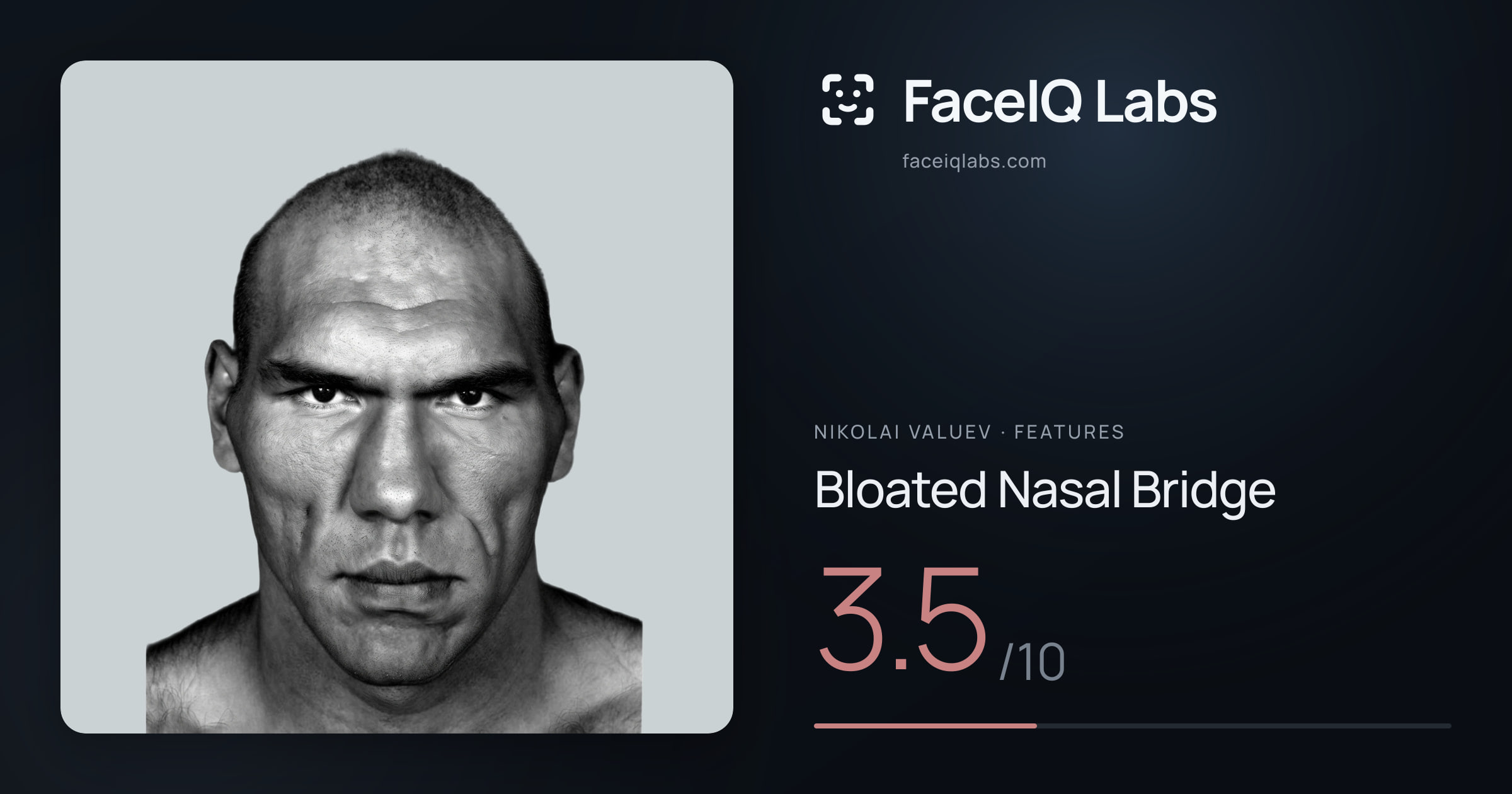 Nikolai Valuev Bloated Nasal Bridge: 3.5/10, drawn on the photo