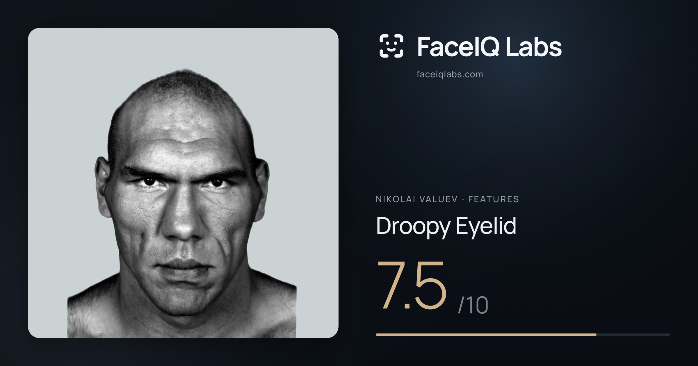 Nikolai Valuev Droopy Eyelid: 7.5/10, drawn on the photo