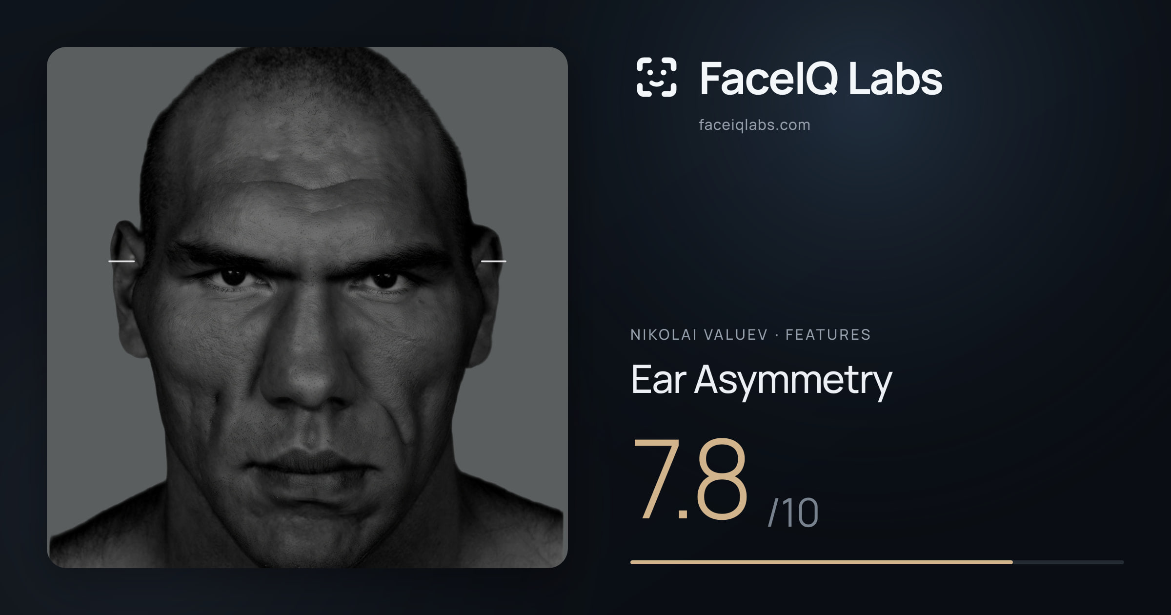 Nikolai Valuev Ear Asymmetry: 7.8/10, drawn on the photo