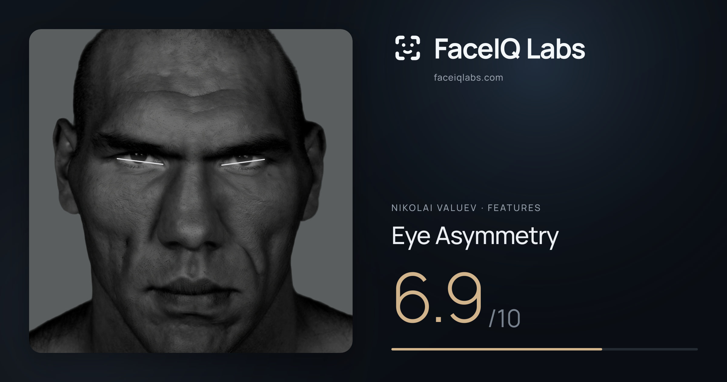 Nikolai Valuev Eye Asymmetry: 6.9/10, drawn on the photo