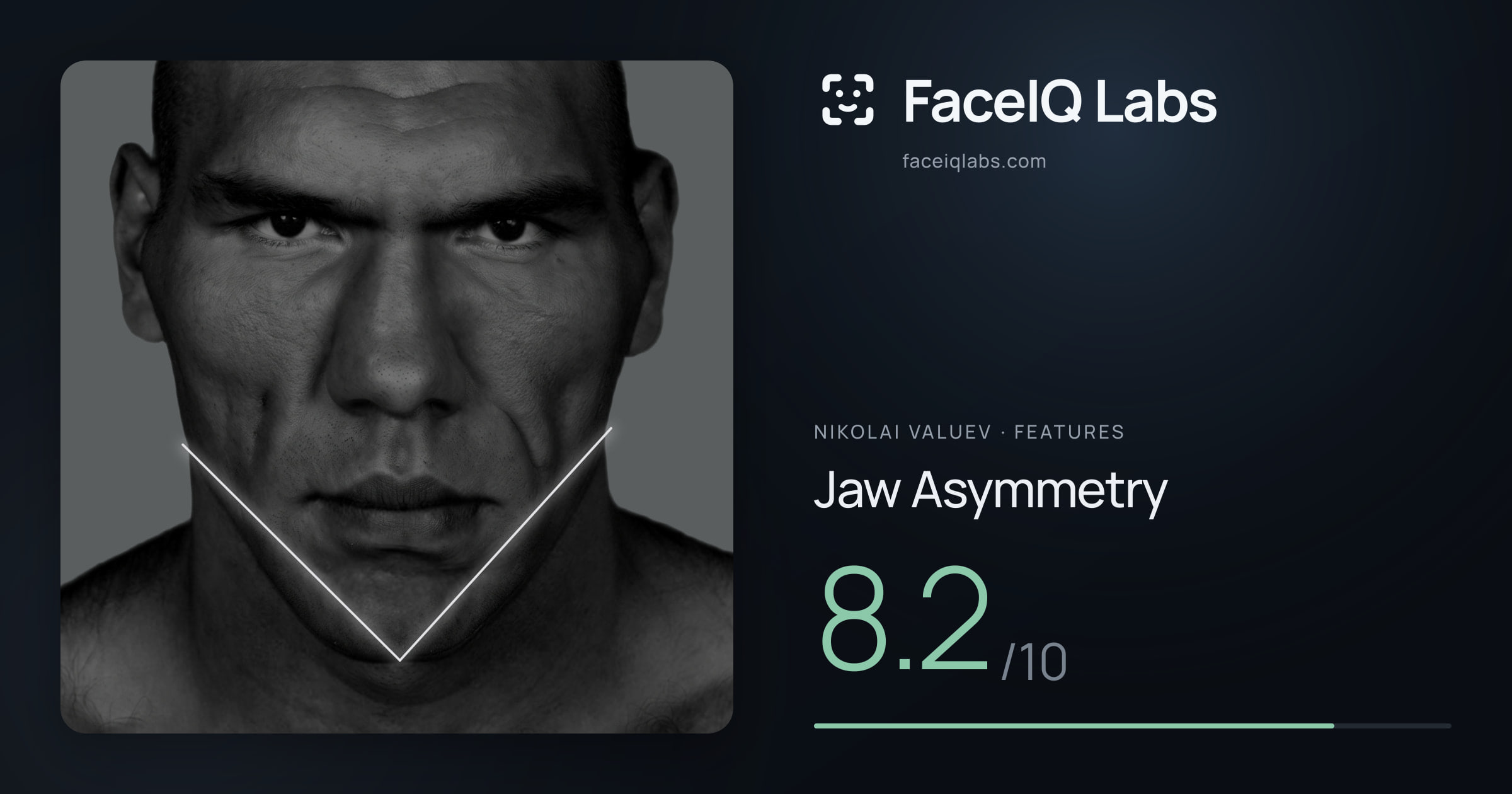Nikolai Valuev Jaw Asymmetry: 8.2/10, drawn on the photo