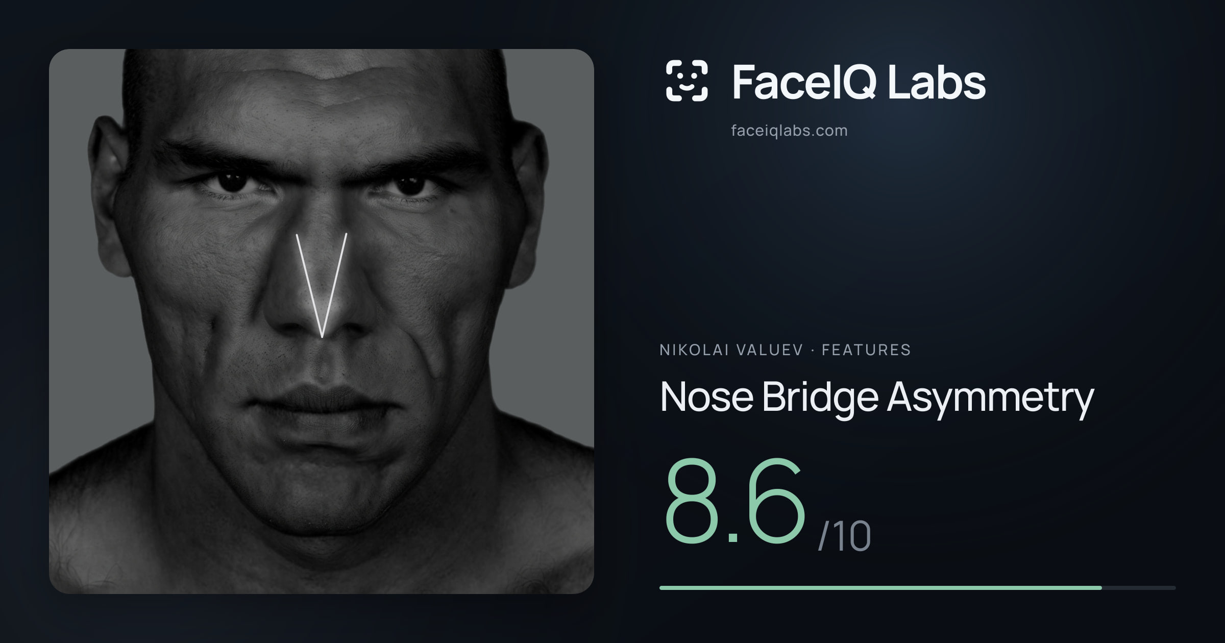 Nikolai Valuev Nose Bridge Asymmetry: 8.6/10, drawn on the photo