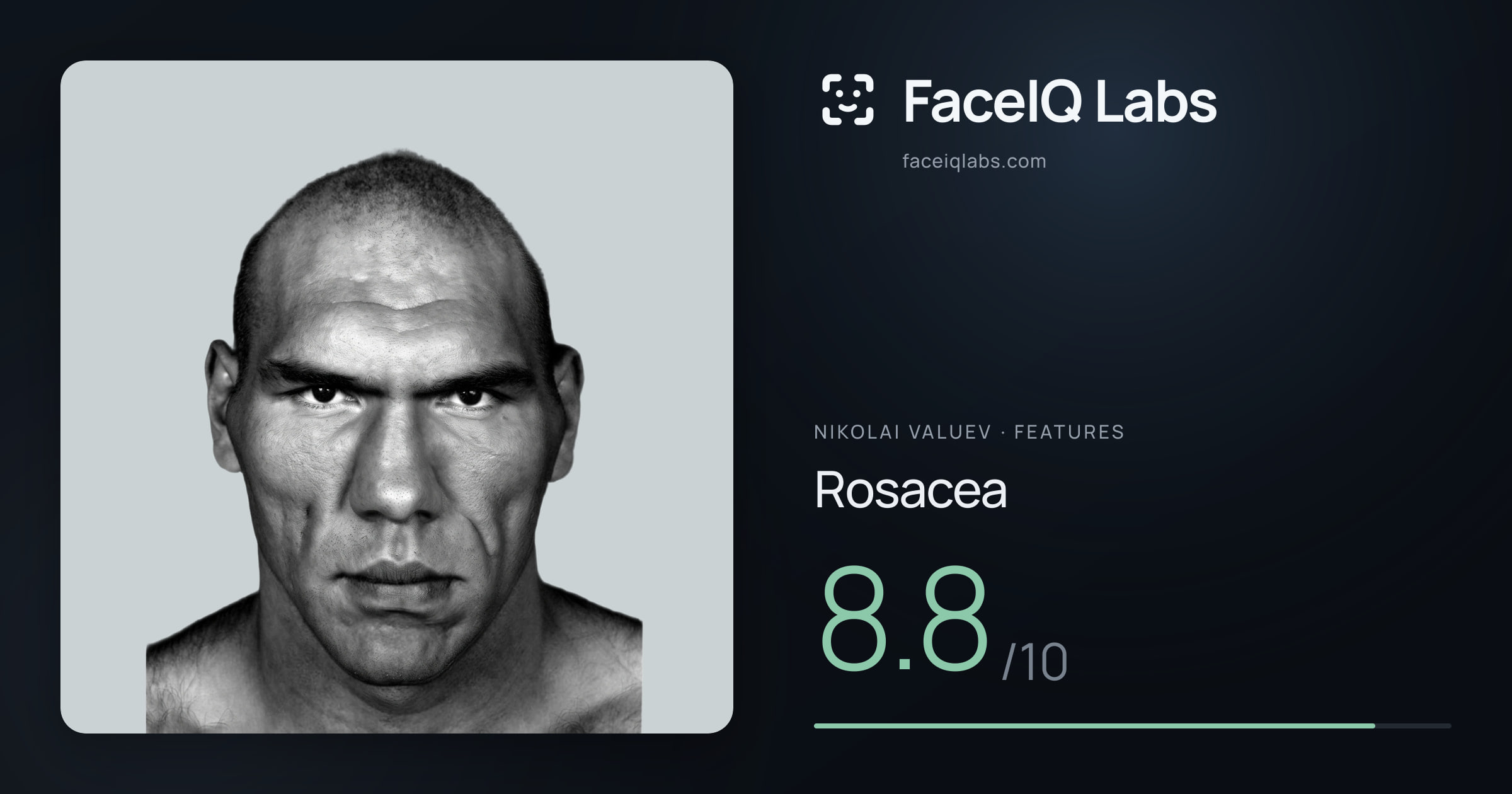 Nikolai Valuev Rosacea: 8.8/10, drawn on the photo