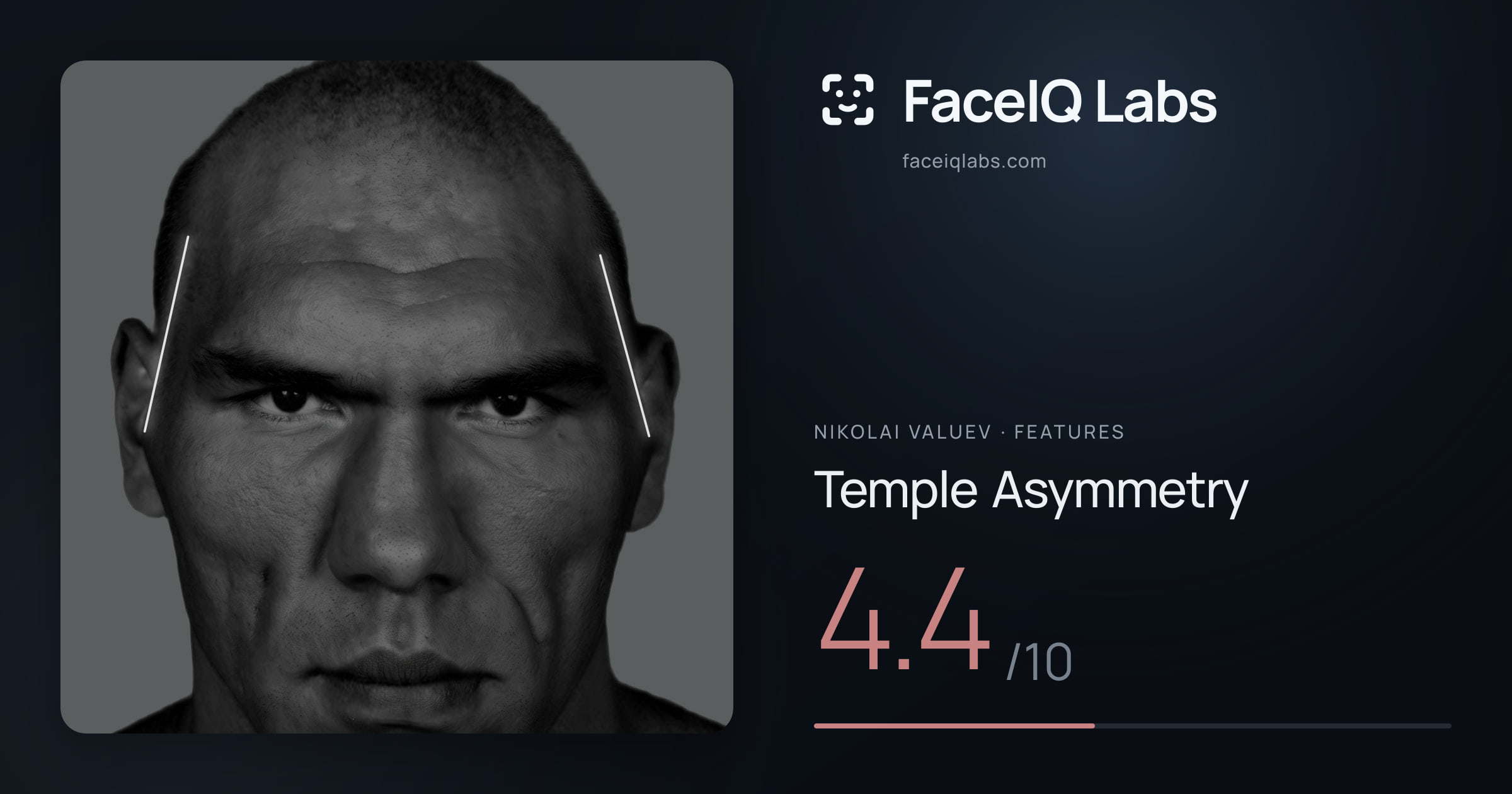 Nikolai Valuev Temple Asymmetry: 4.4/10, drawn on the photo