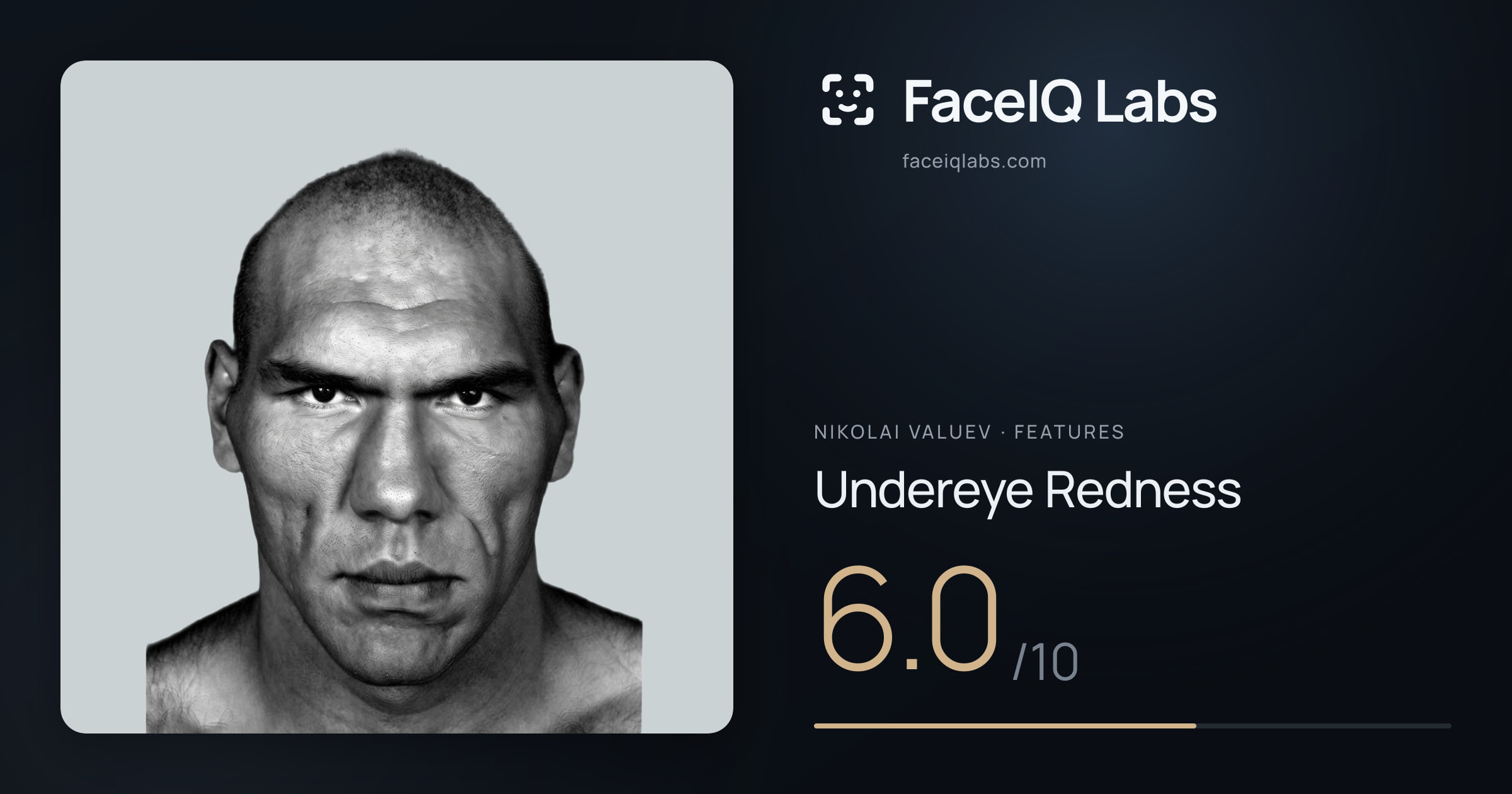Nikolai Valuev Undereye Redness: 6.0/10, drawn on the photo