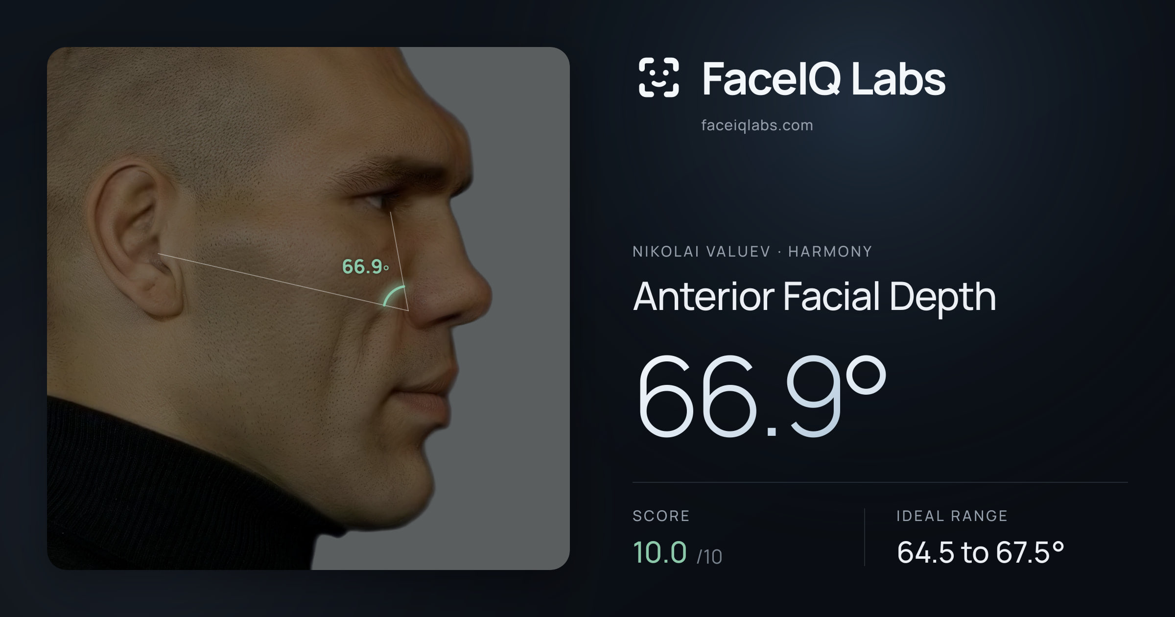 Nikolai Valuev Anterior Facial Depth: 66.9°, drawn on the photo