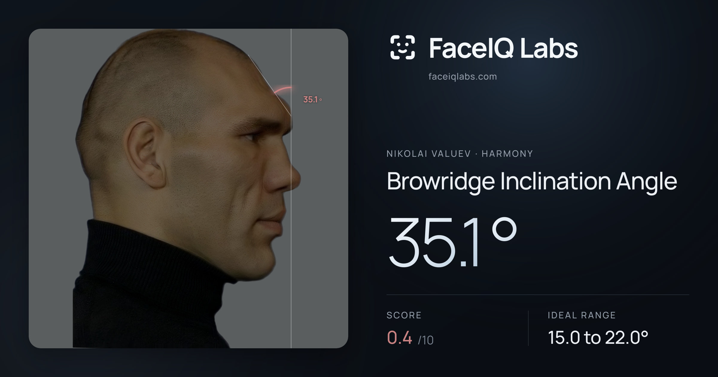 Nikolai Valuev Browridge Inclination Angle: 35.1°, drawn on the photo