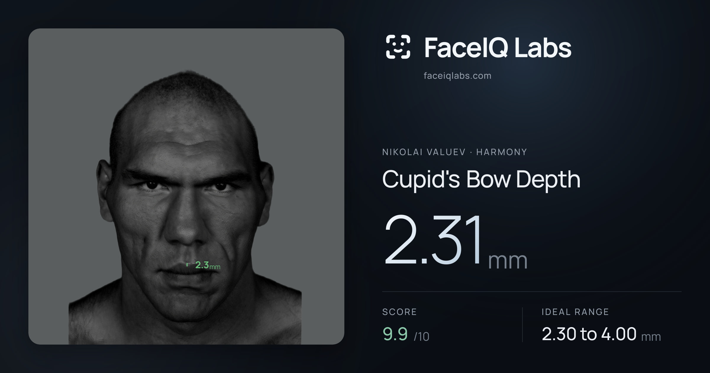Nikolai Valuev Cupid's Bow Depth: 2.31mm, drawn on the photo