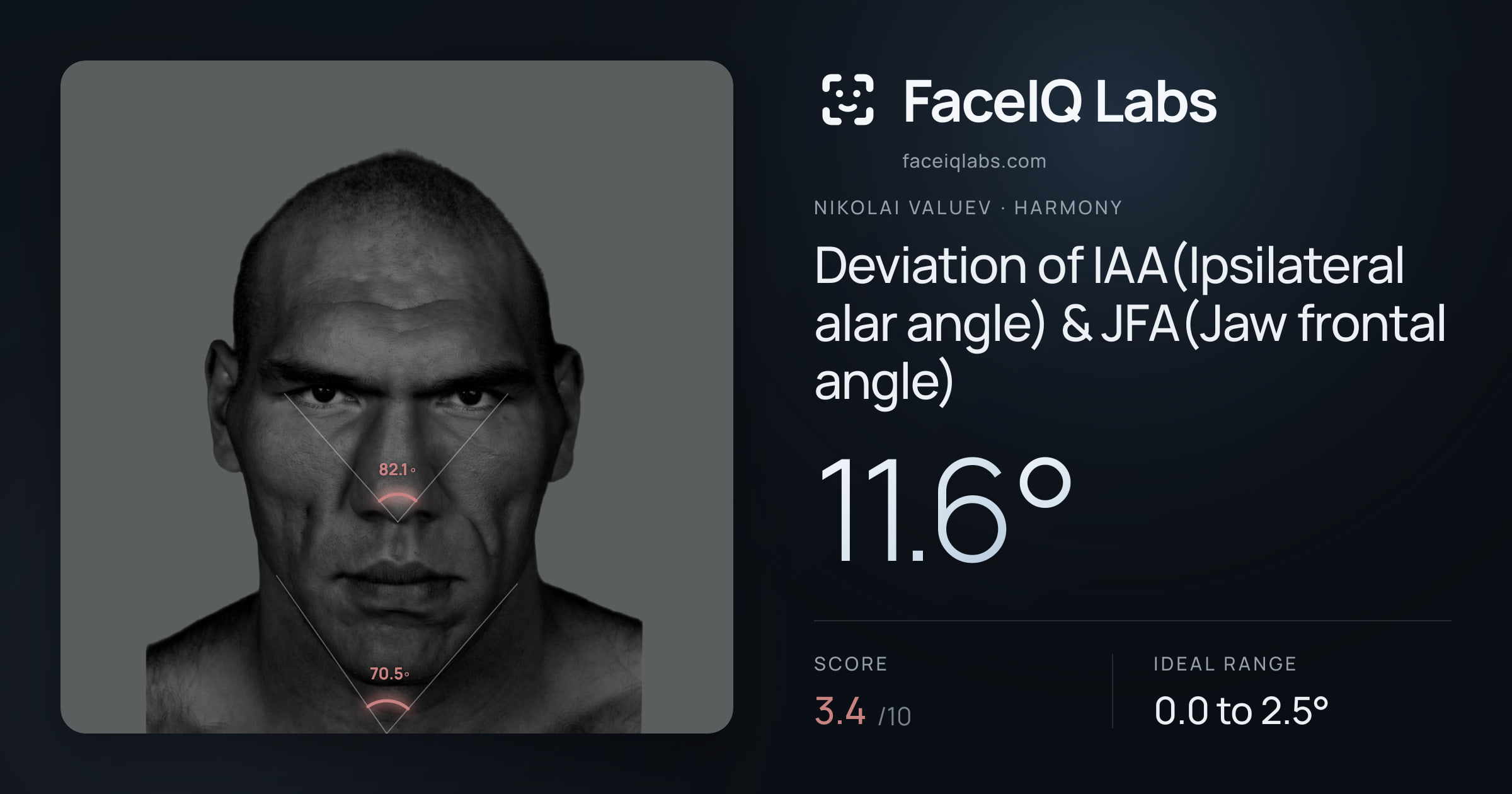 Nikolai Valuev Deviation of IAA(Ipsilateral alar angle) & JFA(Jaw frontal angle): 11.6°, drawn on the photo