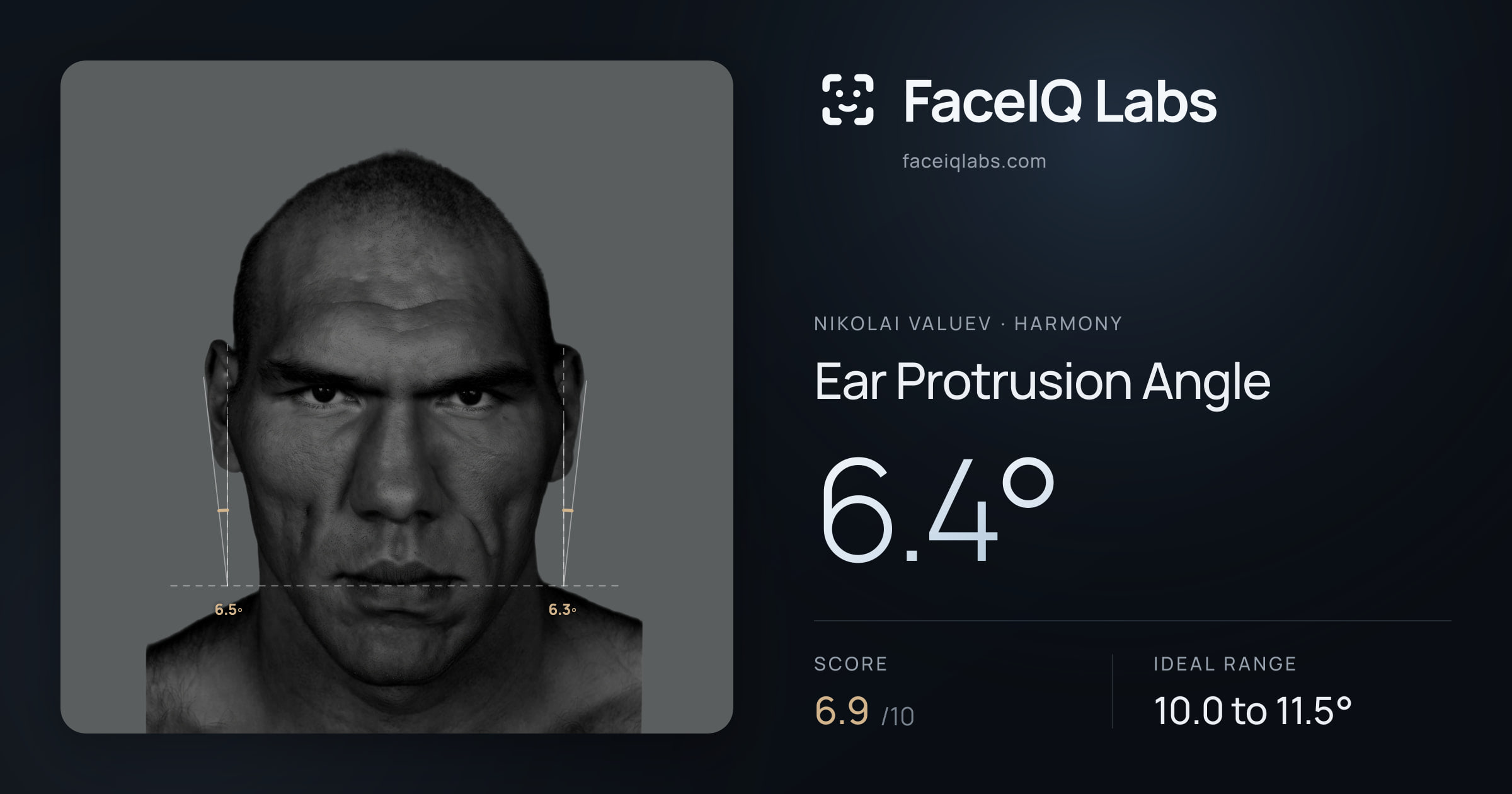 Nikolai Valuev Ear Protrusion Angle: 6.4°, drawn on the photo