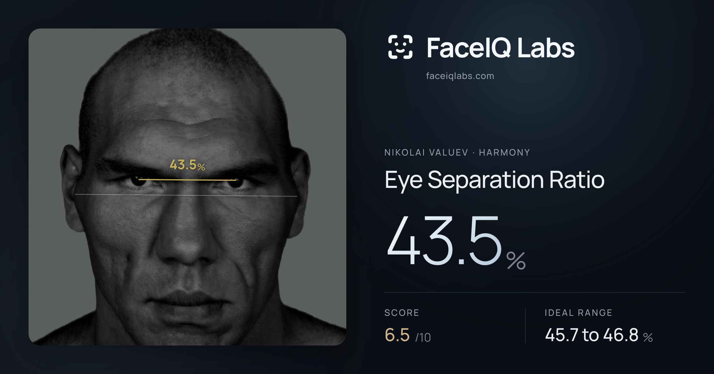 Nikolai Valuev Eye Separation Ratio: 43.5%, drawn on the photo