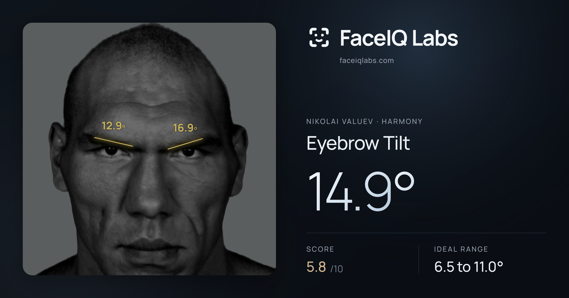 Nikolai Valuev Eyebrow Tilt: 14.9°, drawn on the photo
