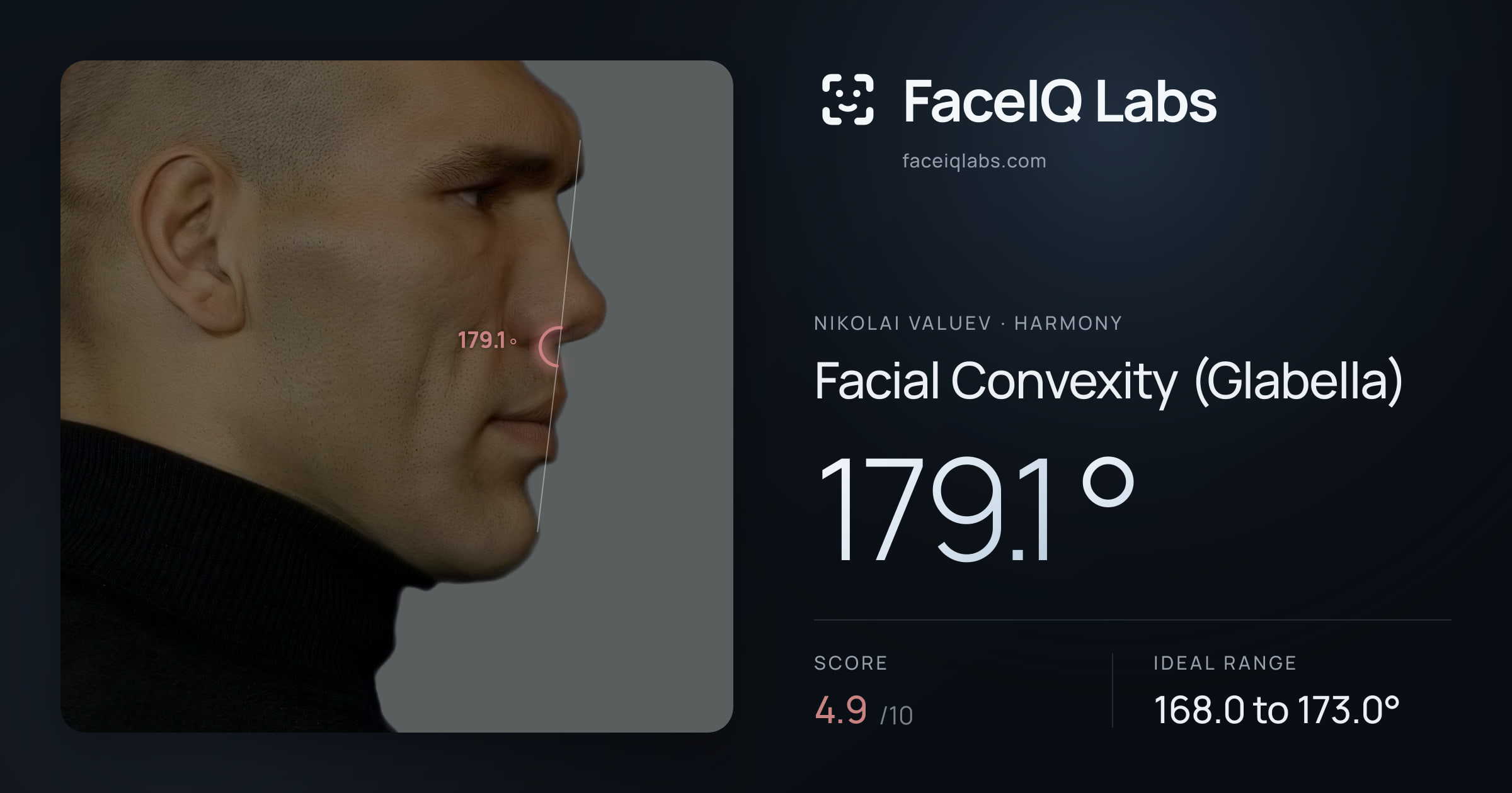 Nikolai Valuev Facial Convexity (Glabella): 179.1°, drawn on the photo