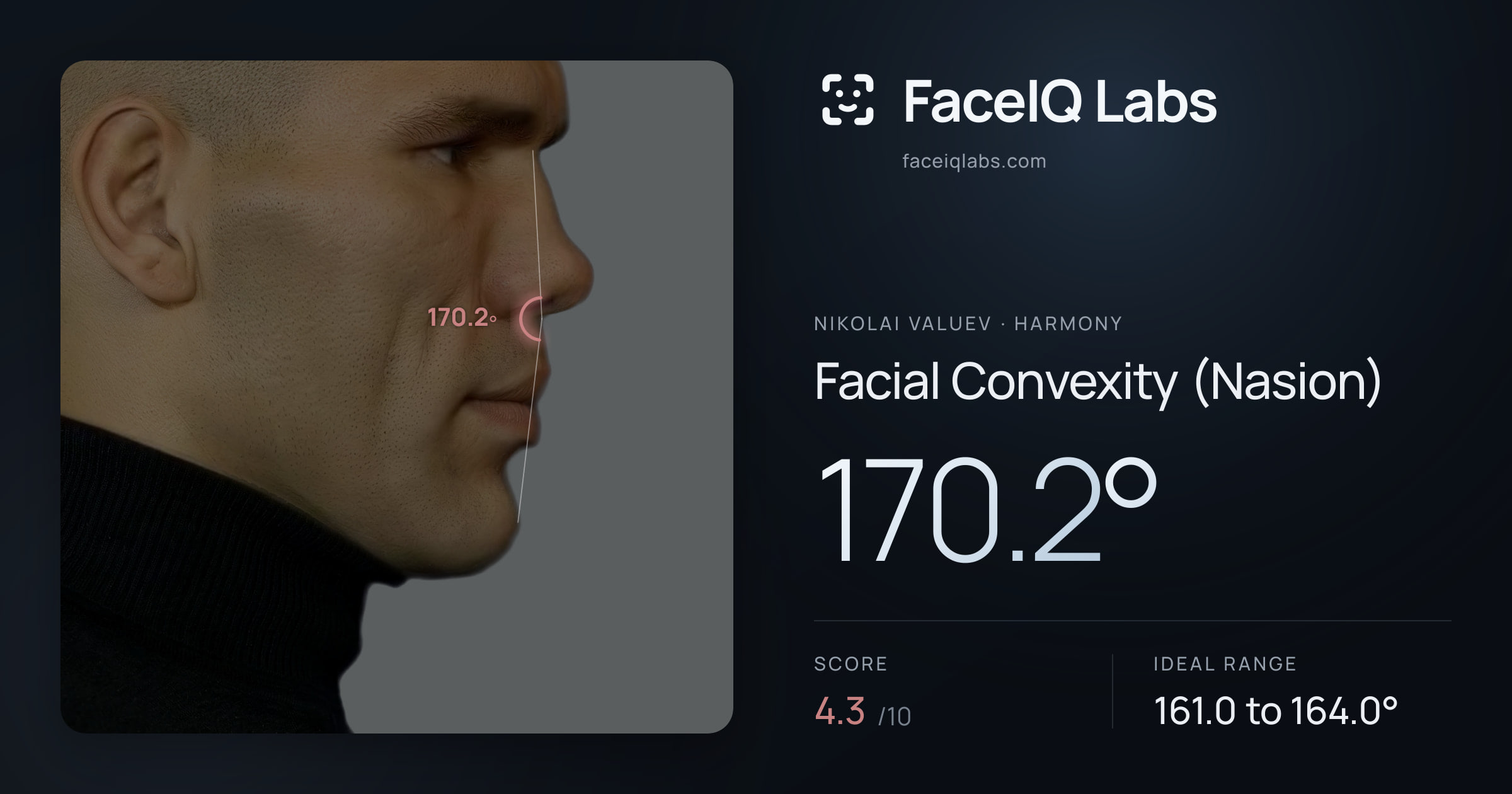 Nikolai Valuev Facial Convexity (Nasion): 170.2°, drawn on the photo