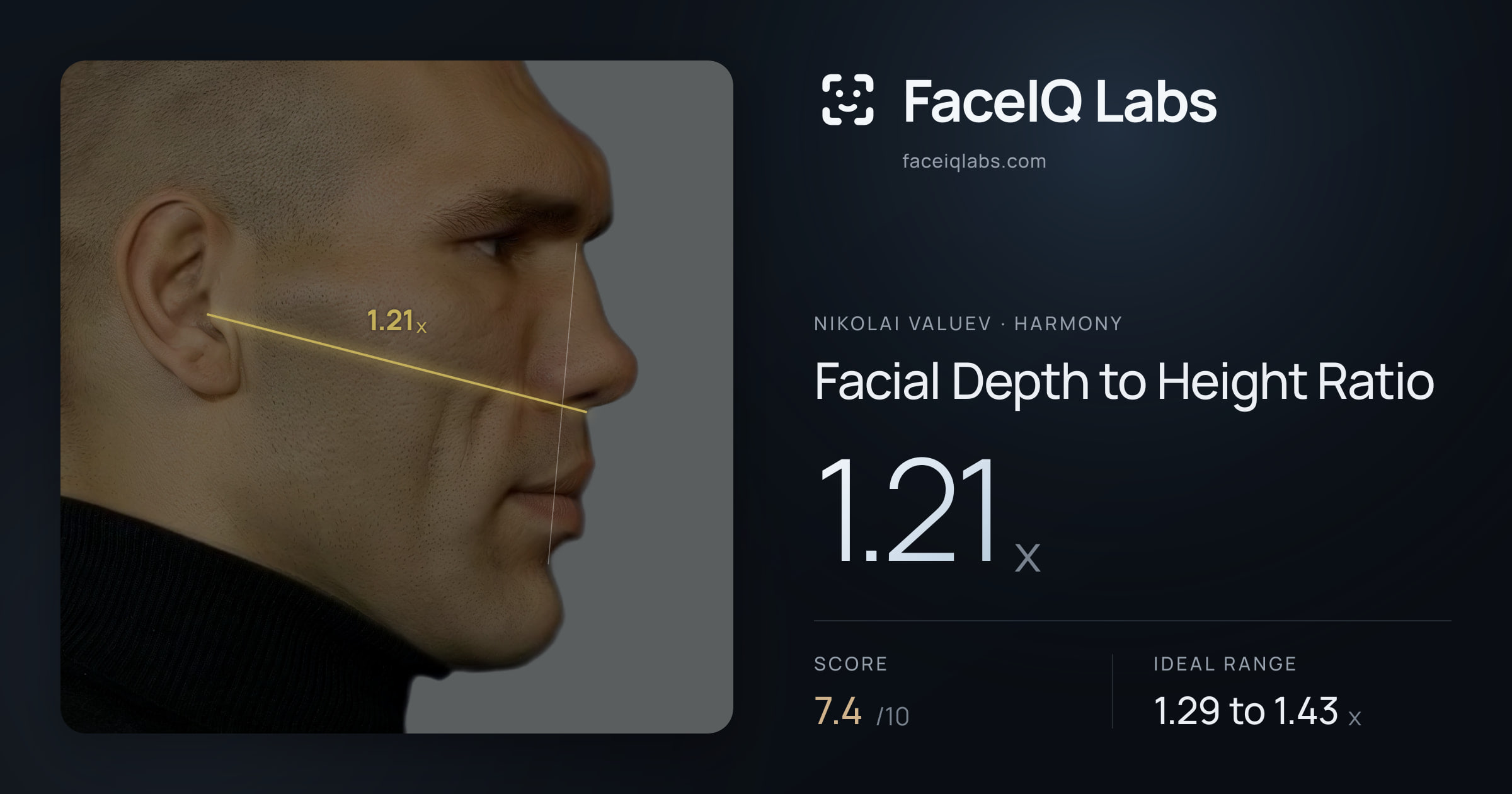 Nikolai Valuev Facial Depth to Height Ratio: 1.21x, drawn on the photo