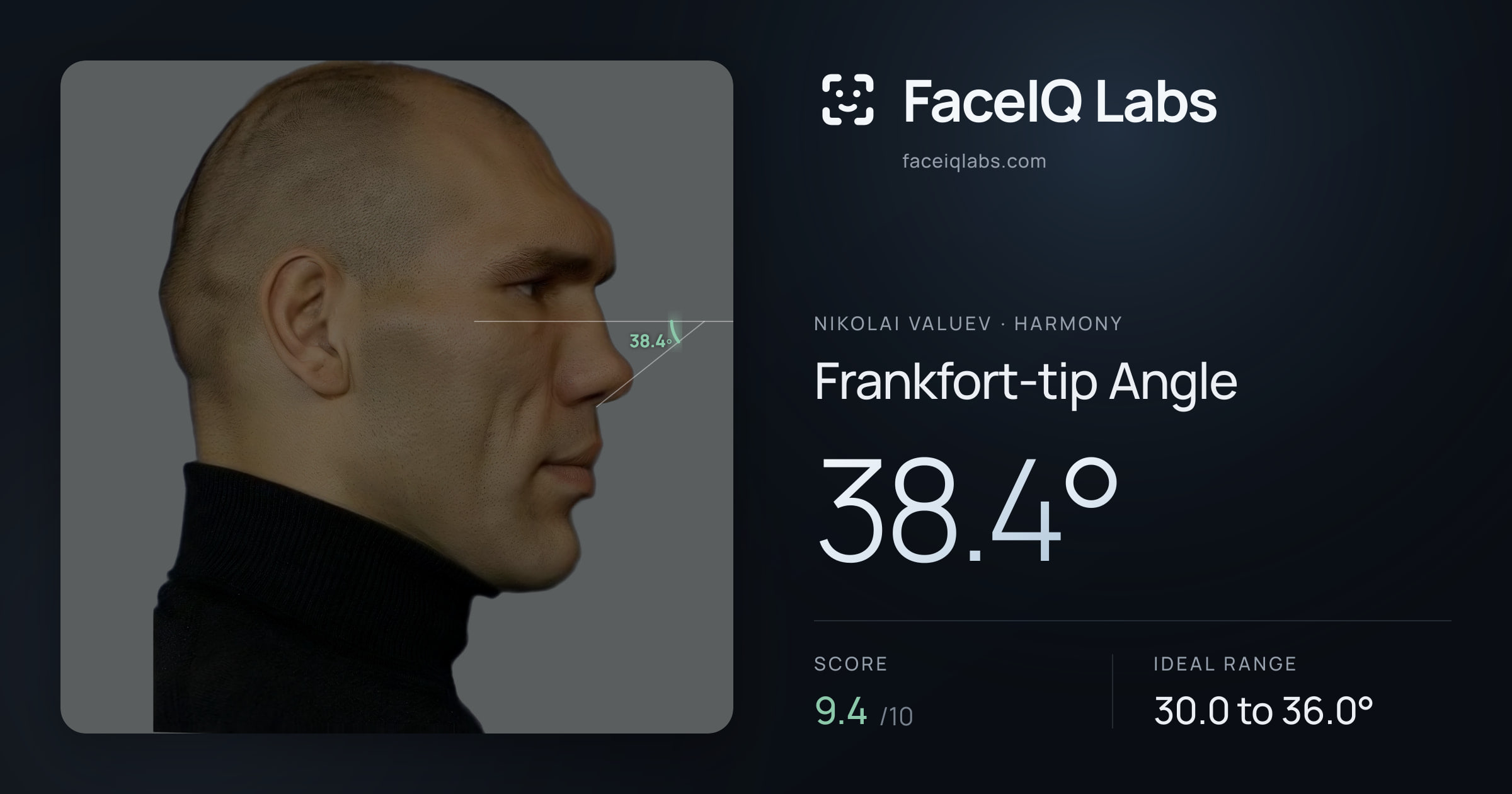 Nikolai Valuev Frankfort-tip Angle: 38.4°, drawn on the photo