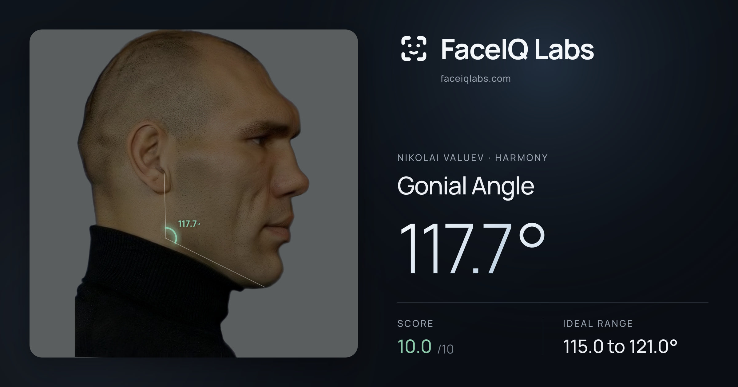 Nikolai Valuev Gonial Angle: 117.7°, drawn on the photo