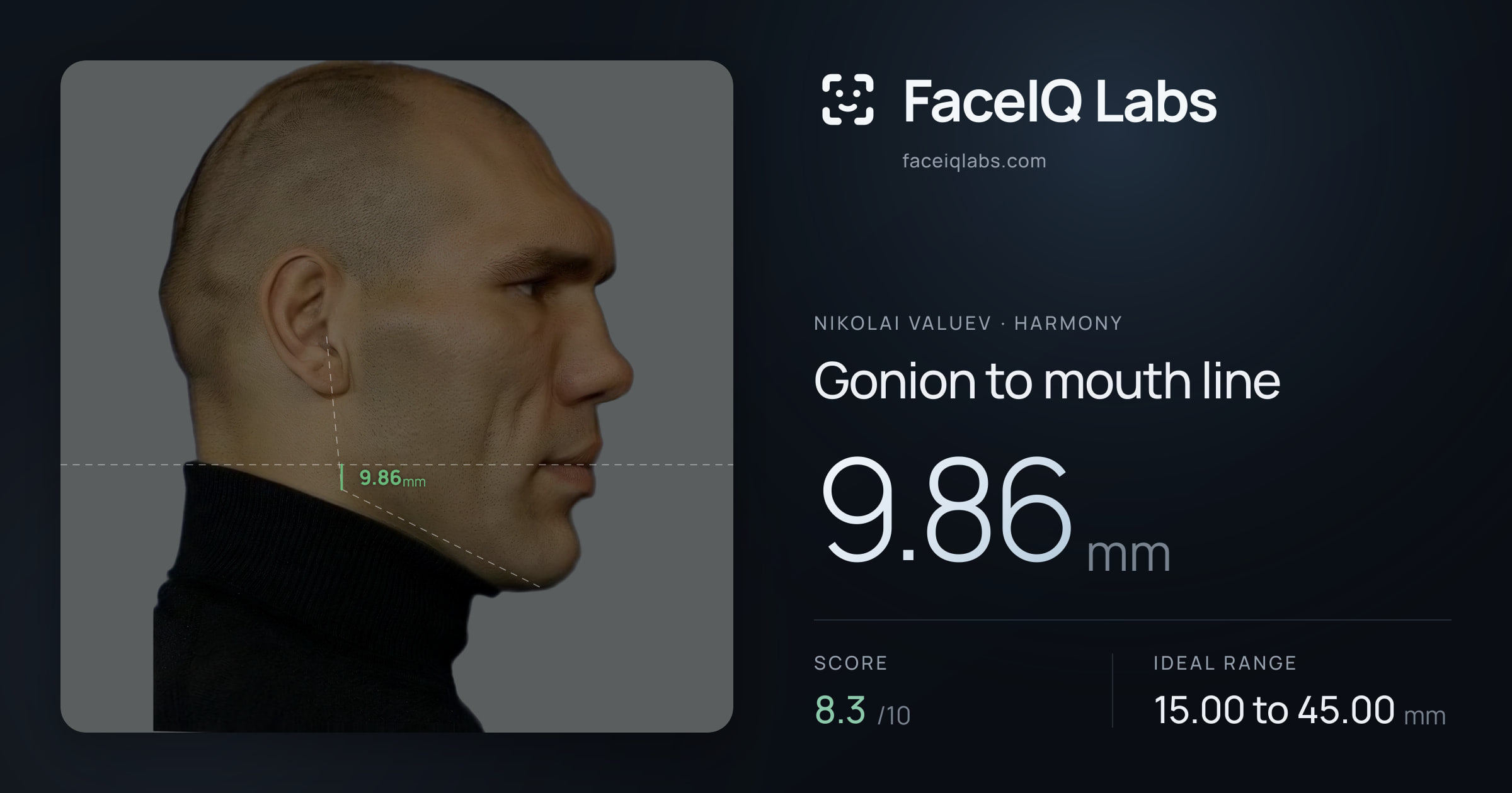 Nikolai Valuev Gonion to mouth line: 9.86mm, drawn on the photo