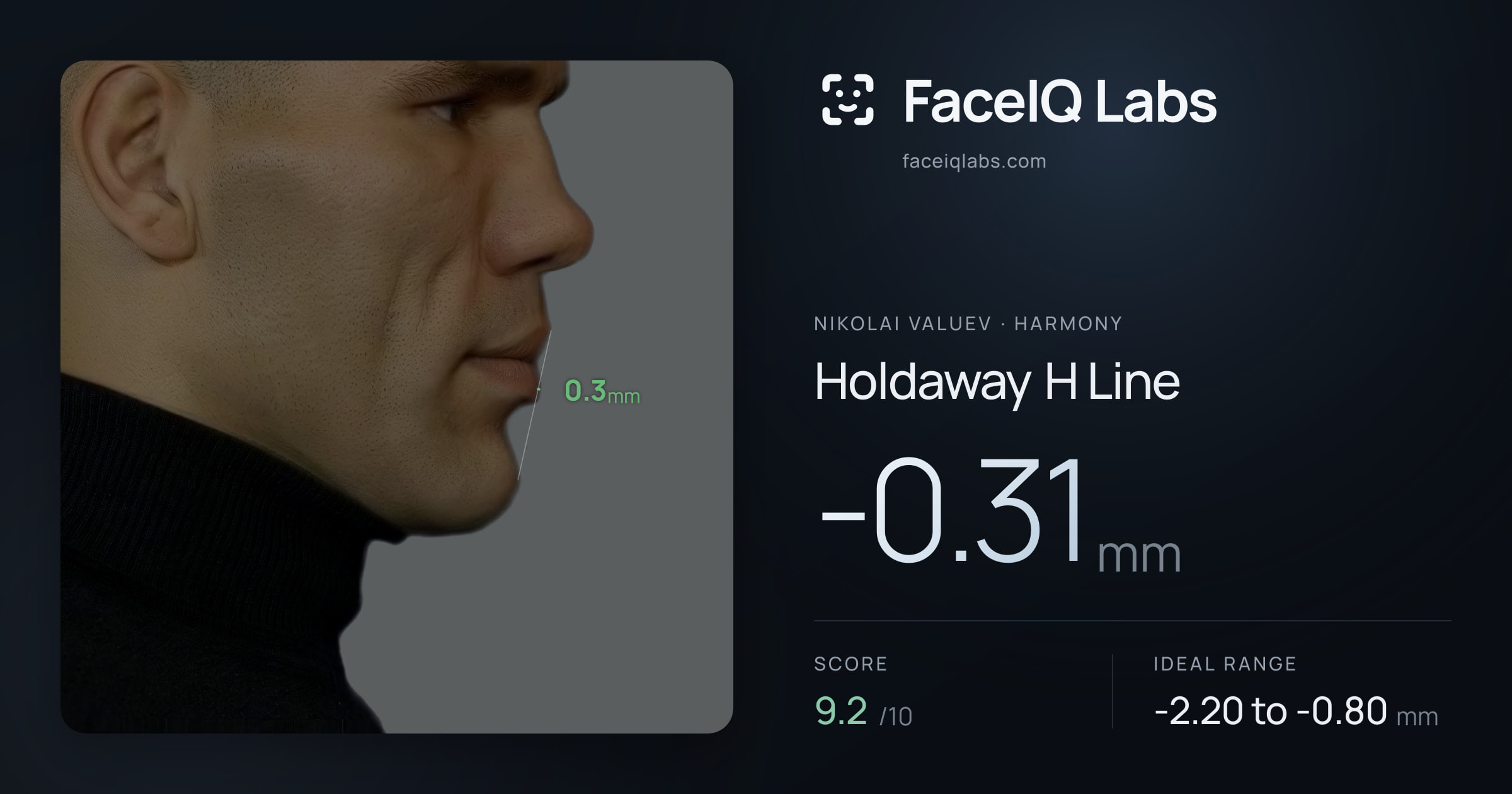 Nikolai Valuev Holdaway H Line: -0.31mm, drawn on the photo
