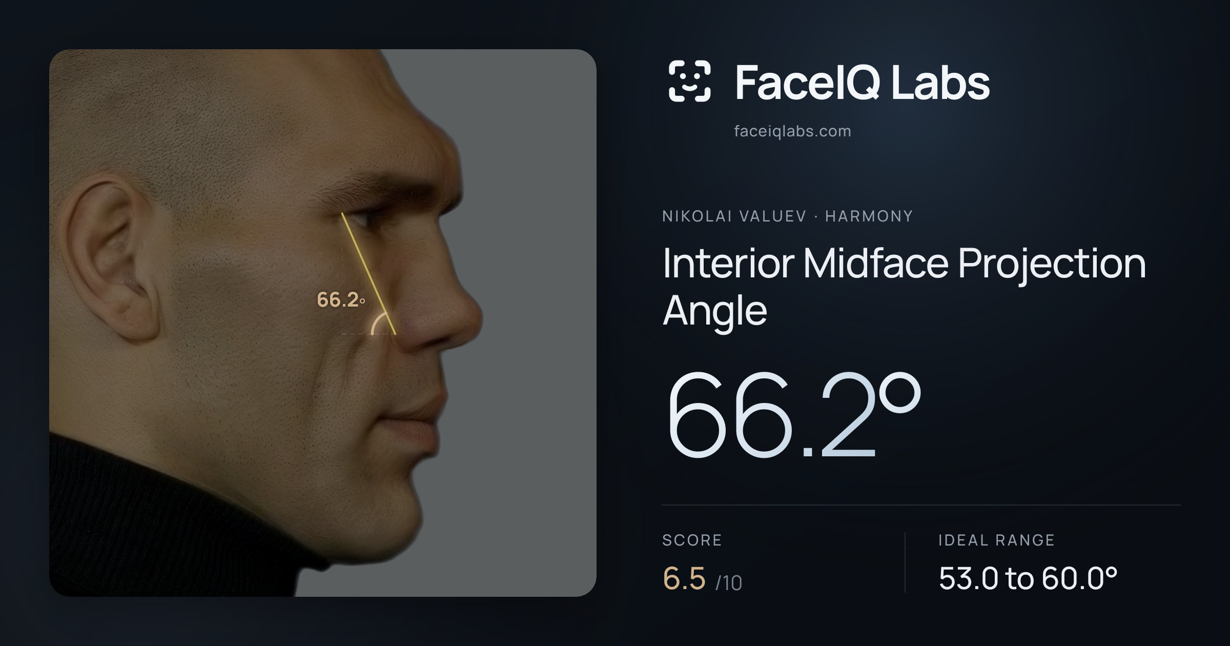 Nikolai Valuev Interior Midface Projection Angle: 66.2°, drawn on the photo