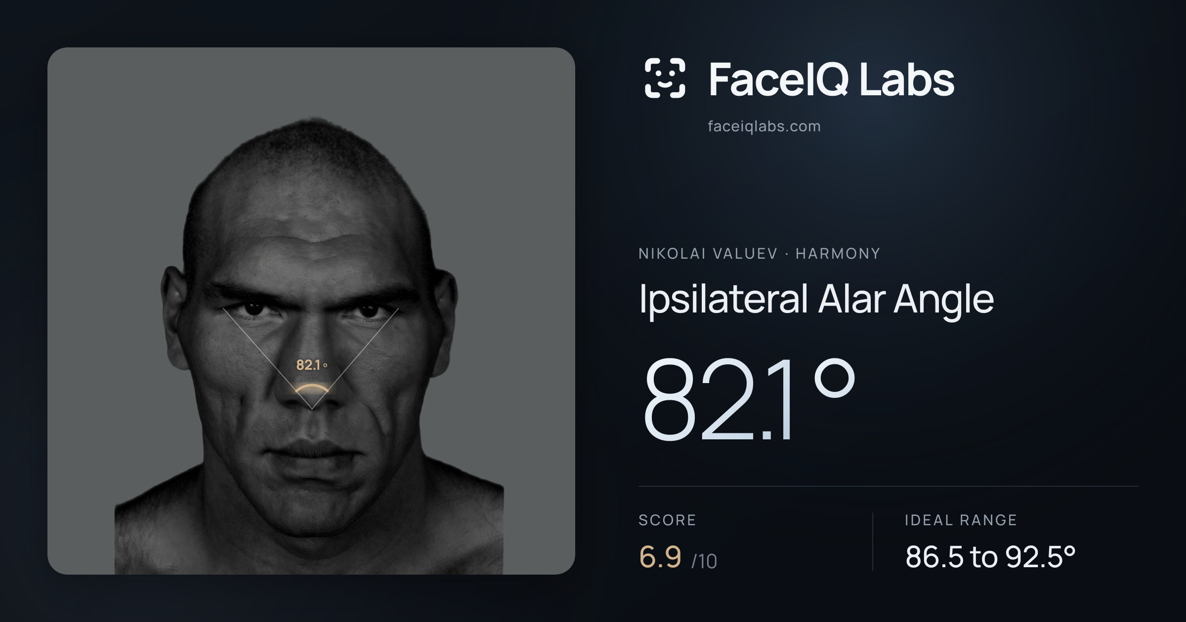 Nikolai Valuev Ipsilateral Alar Angle: 82.1°, drawn on the photo