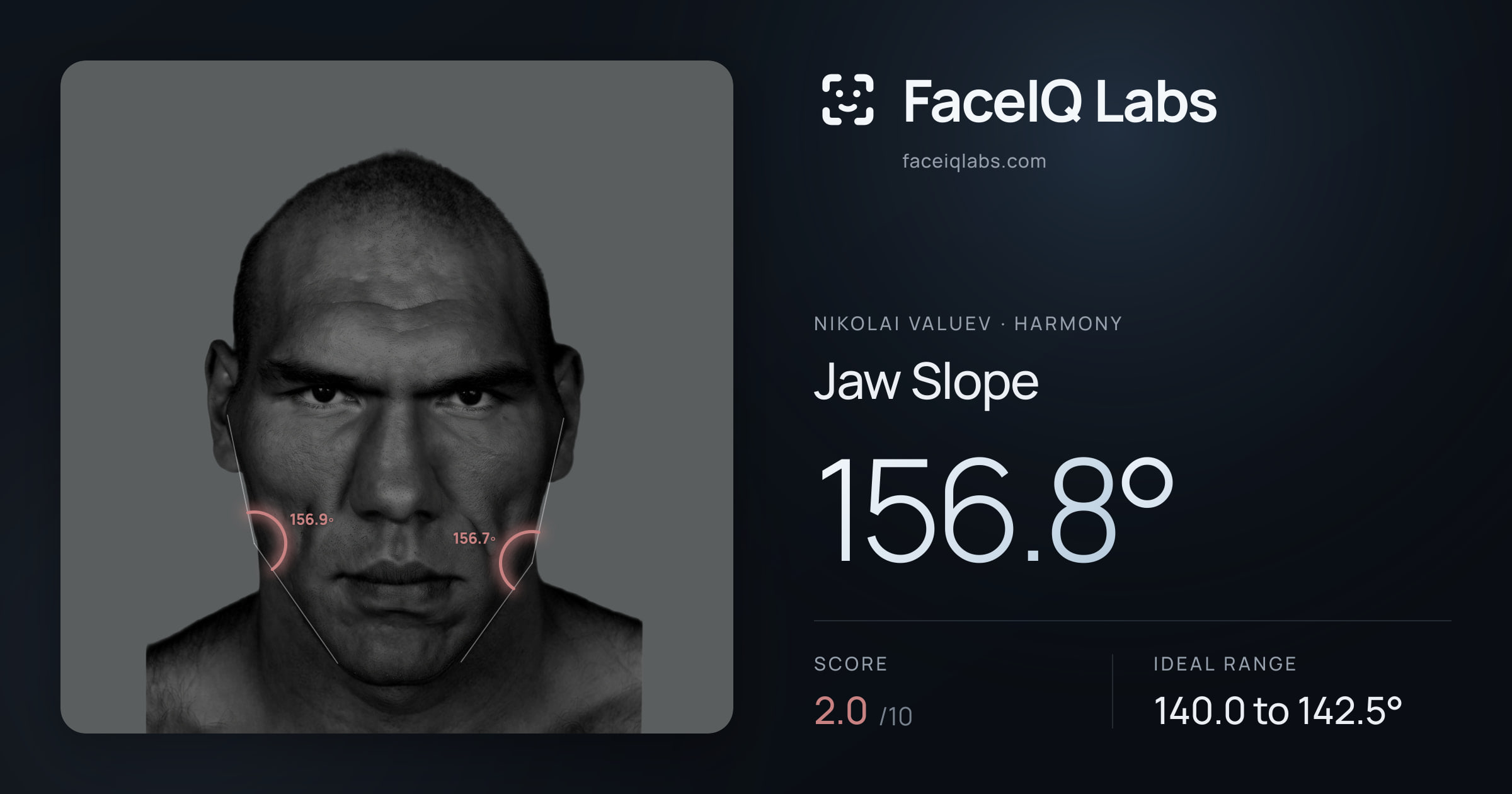 Nikolai Valuev Jaw Slope: 156.8°, drawn on the photo