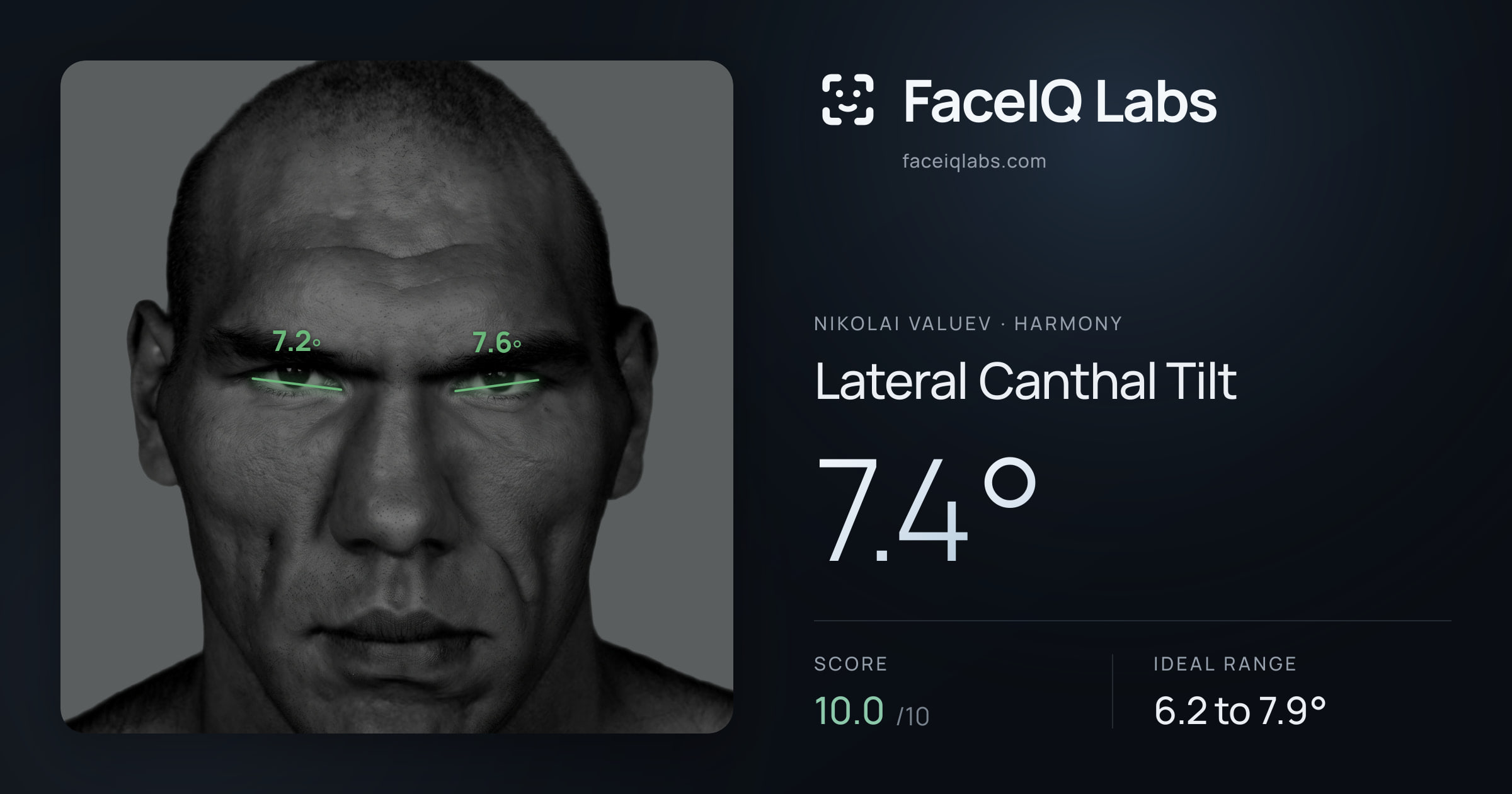 Nikolai Valuev Lateral Canthal Tilt: 7.4°, drawn on the photo