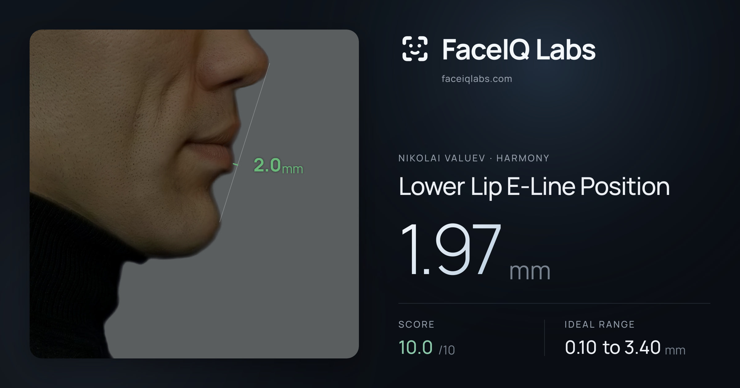 Nikolai Valuev Lower Lip E-Line Position: 1.97mm, drawn on the photo