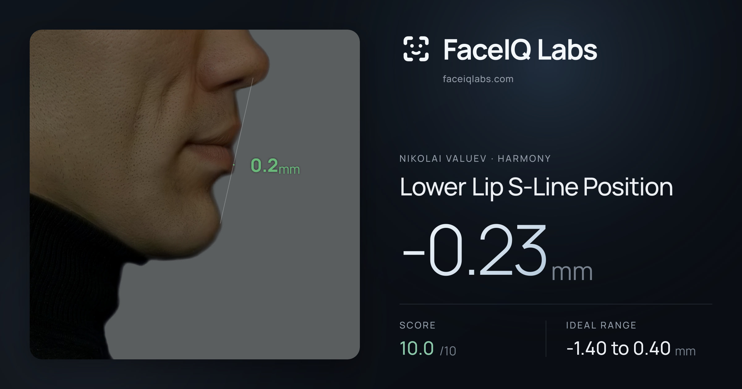 Nikolai Valuev Lower Lip S-Line Position: -0.23mm, drawn on the photo
