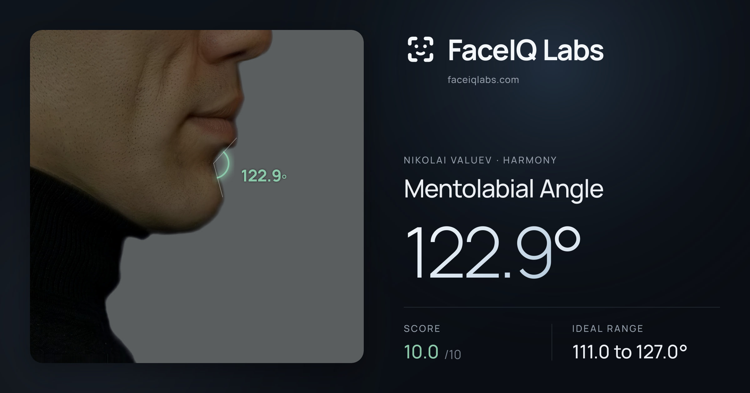 Nikolai Valuev Mentolabial Angle: 122.9°, drawn on the photo