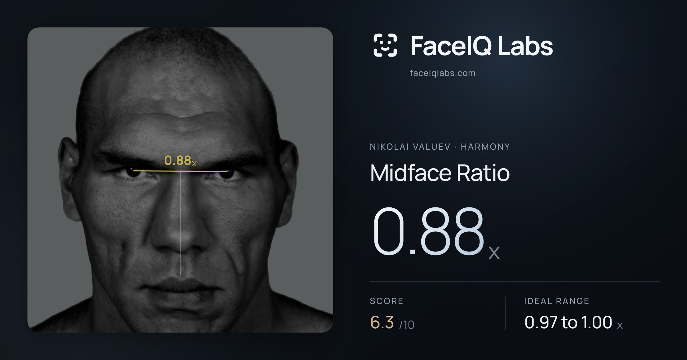 Nikolai Valuev Midface Ratio: 0.88x, drawn on the photo