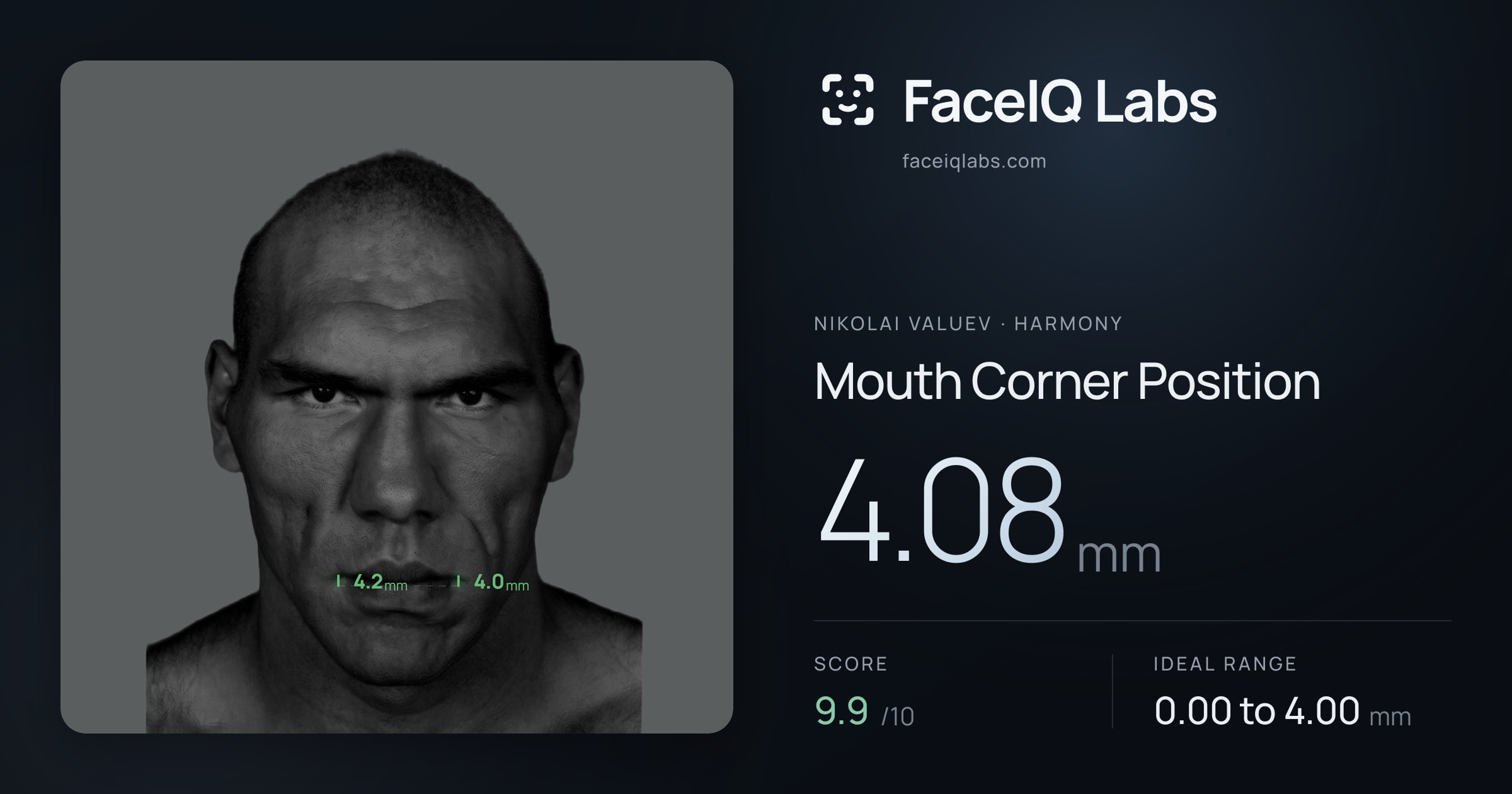 Nikolai Valuev Mouth Corner Position: 4.08mm, drawn on the photo