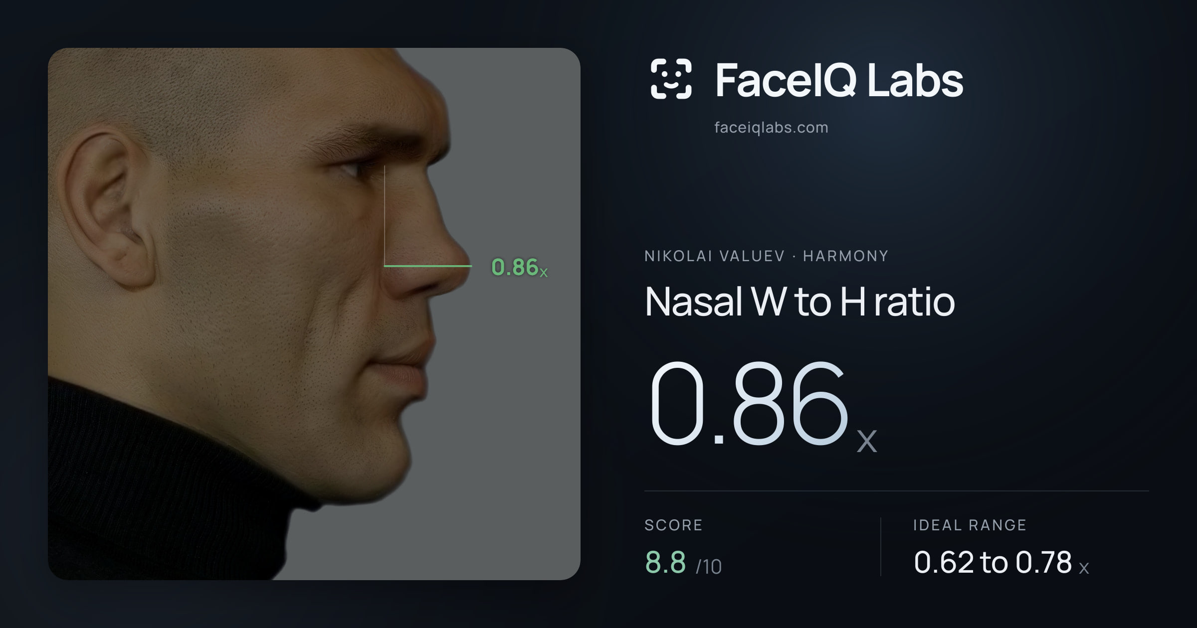 Nikolai Valuev Nasal W to H ratio: 0.86x, drawn on the photo