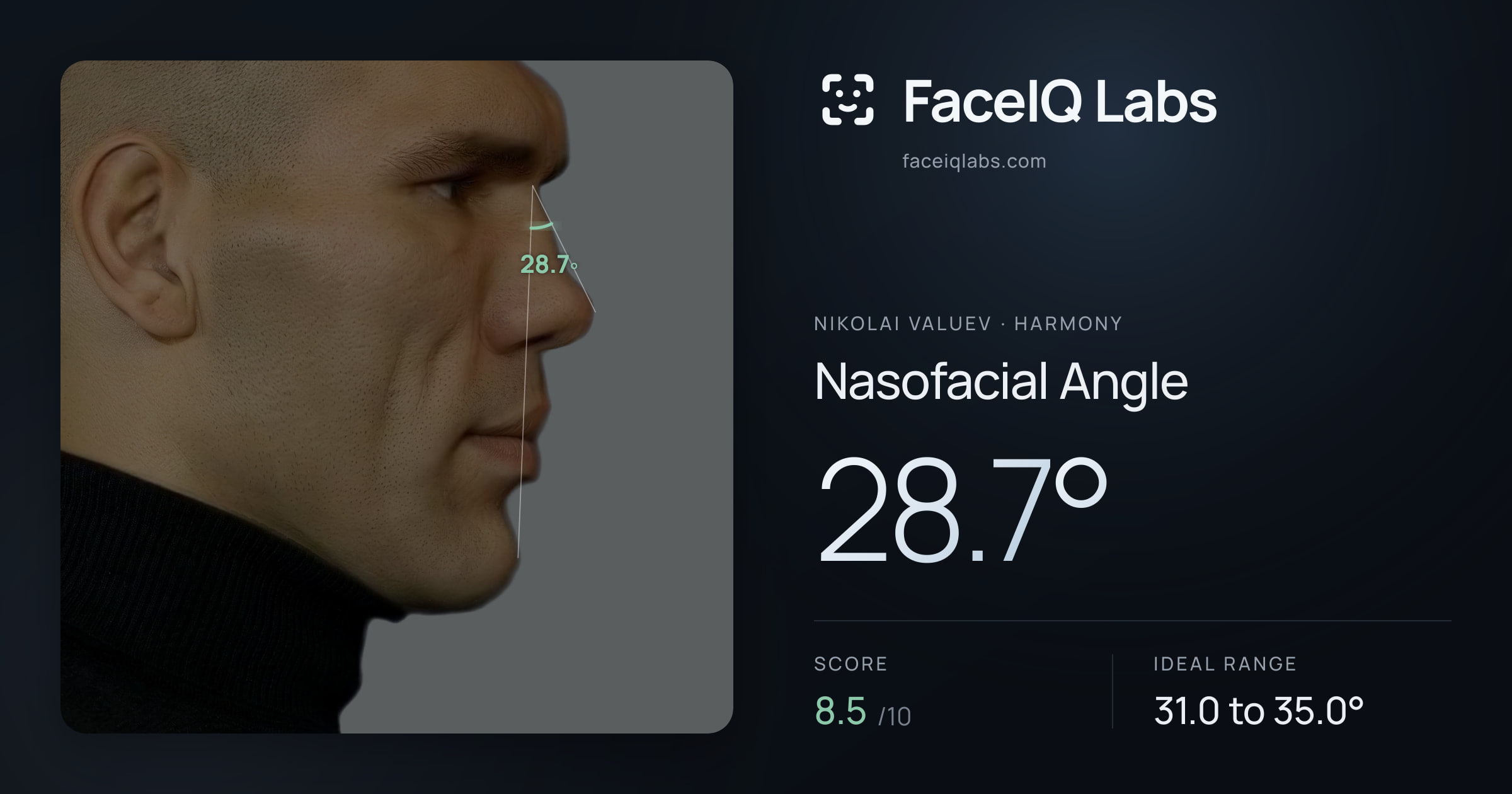 Nikolai Valuev Nasofacial Angle: 28.7°, drawn on the photo