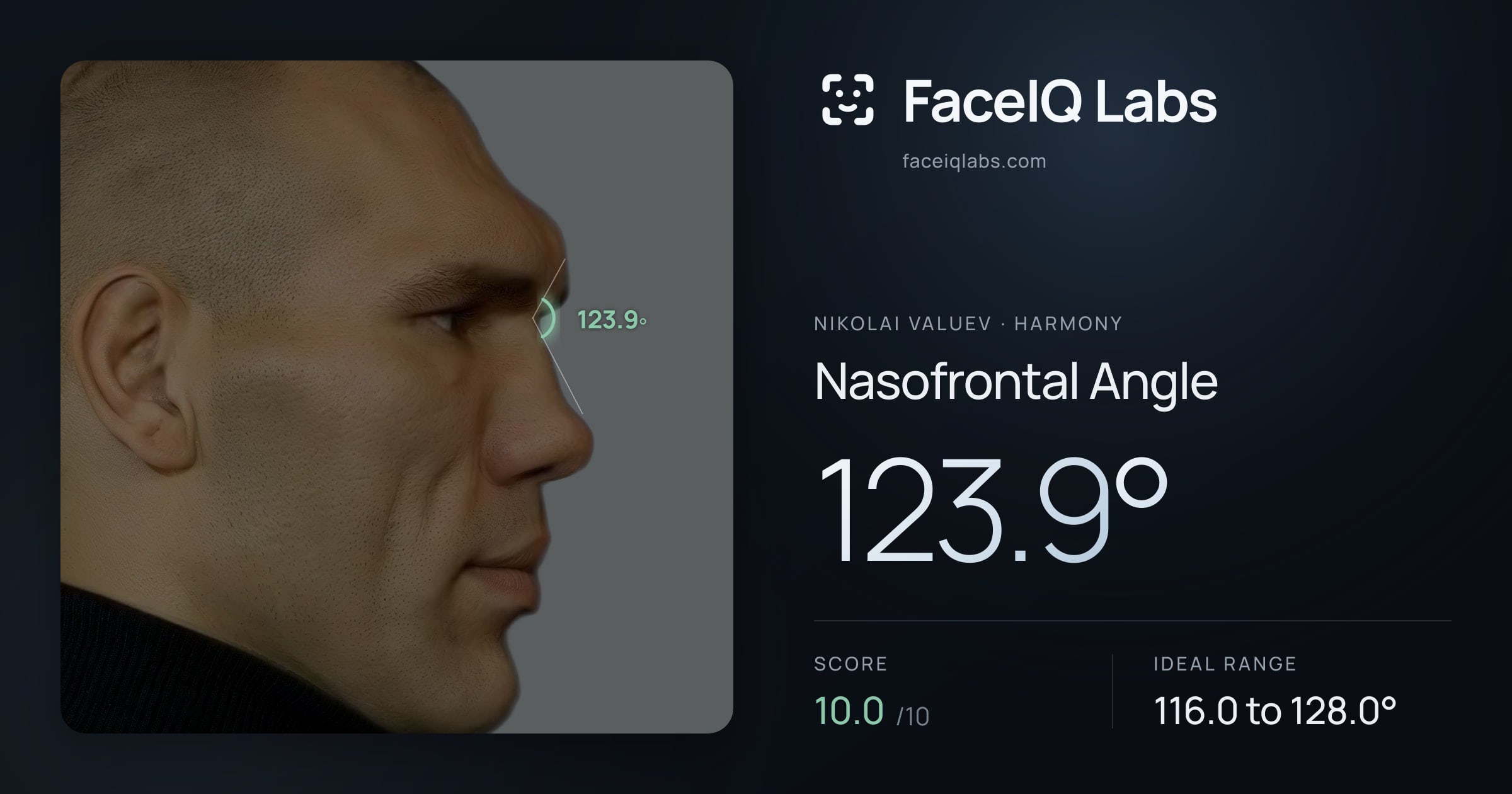 Nikolai Valuev Nasofrontal Angle: 123.9°, drawn on the photo