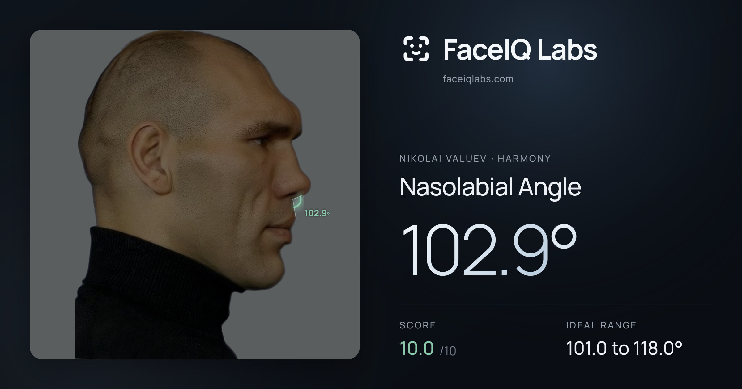 Nikolai Valuev Nasolabial Angle: 102.9°, drawn on the photo