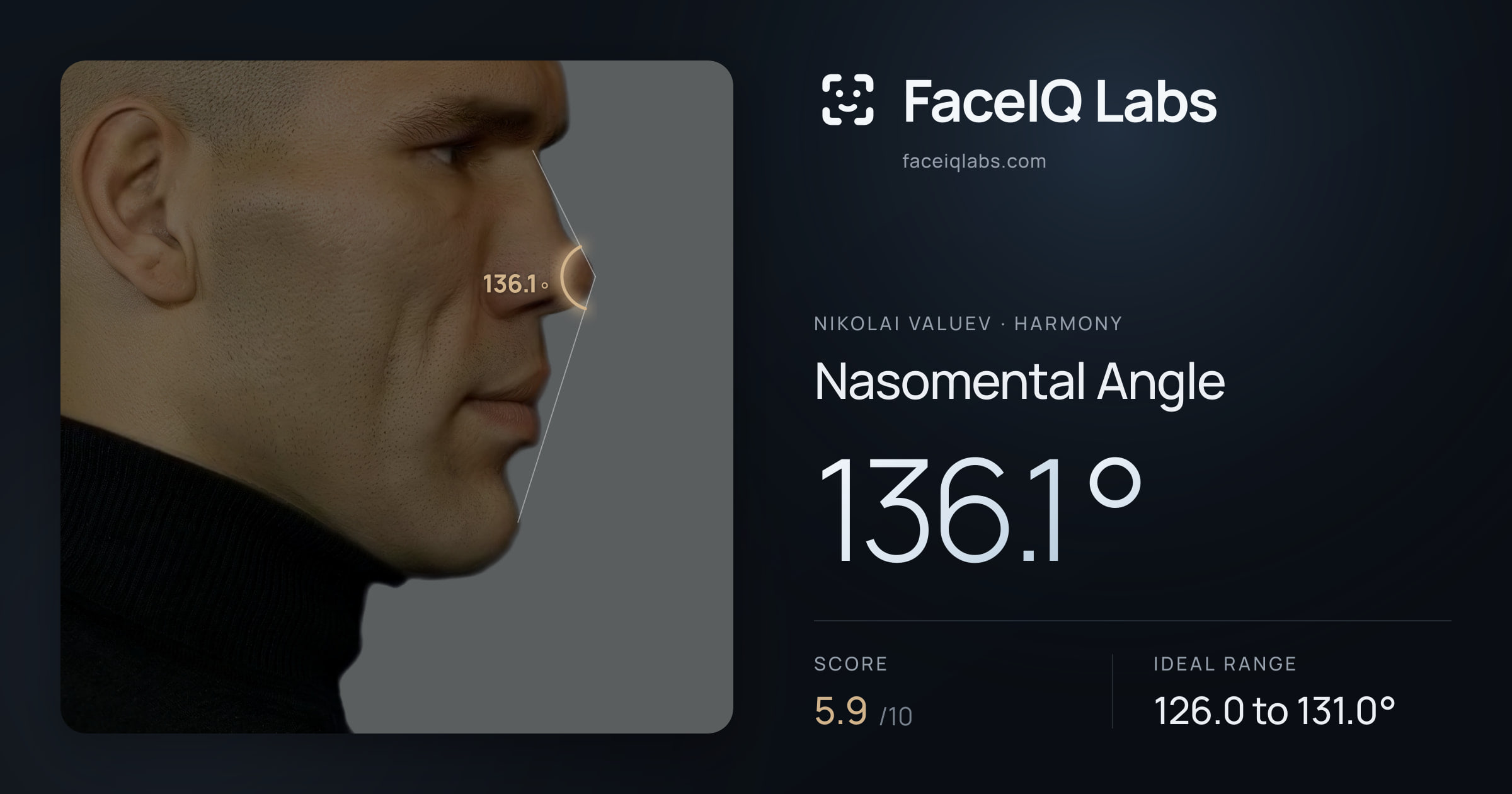 Nikolai Valuev Nasomental Angle: 136.1°, drawn on the photo